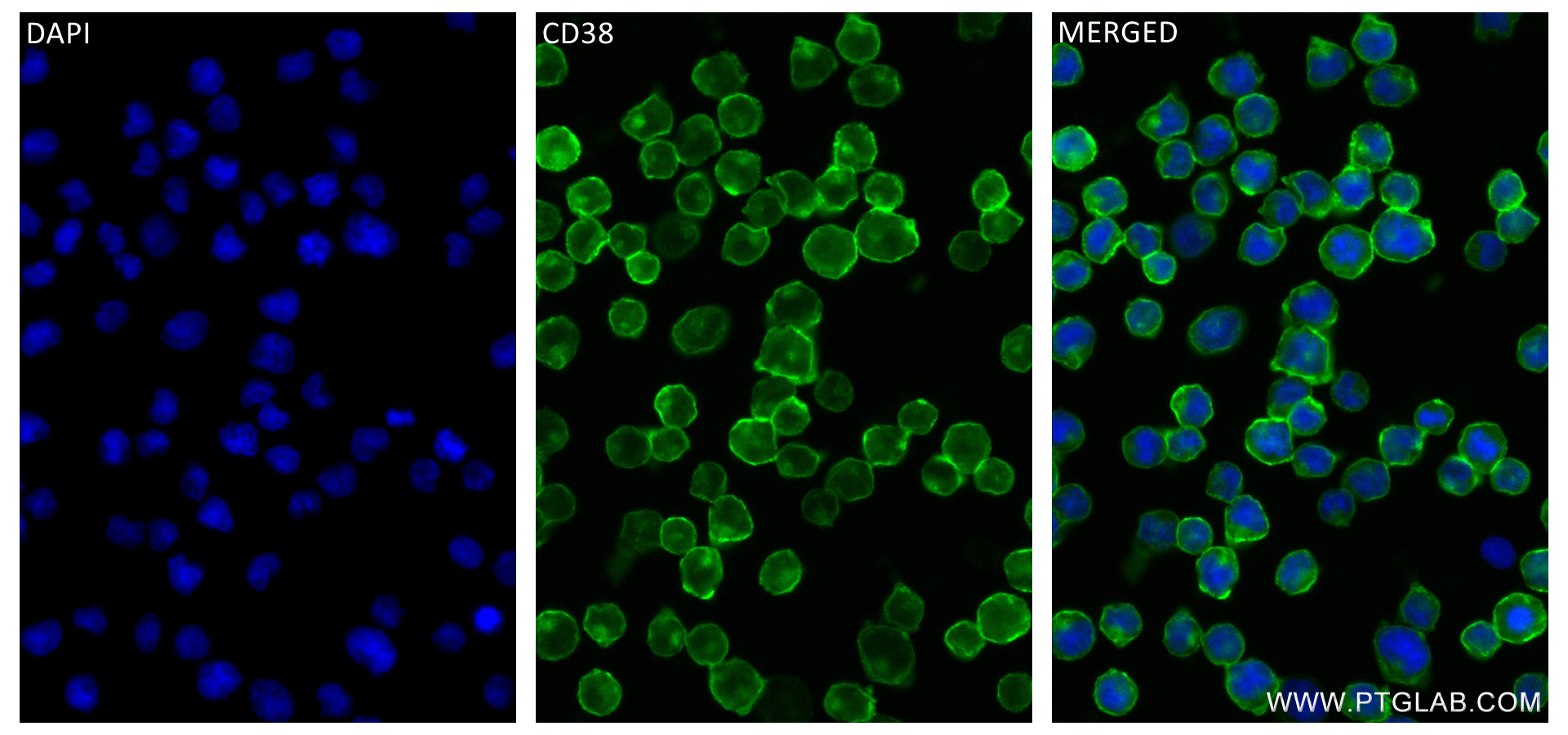 IF Staining of Raji using 84070-6-RR