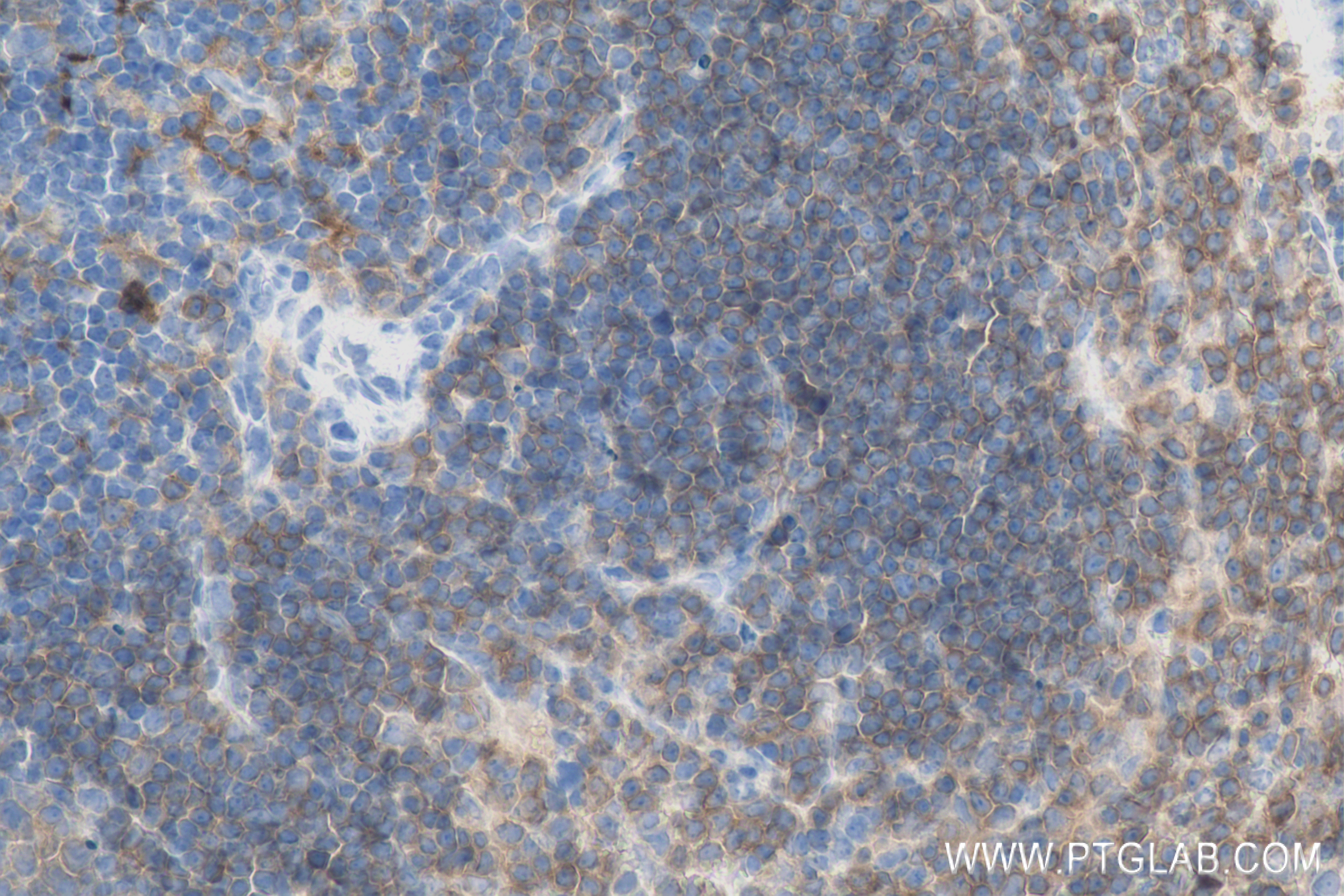 IHC staining of mouse spleen using 83972-5-RR (same clone as 83972-5-PBS)