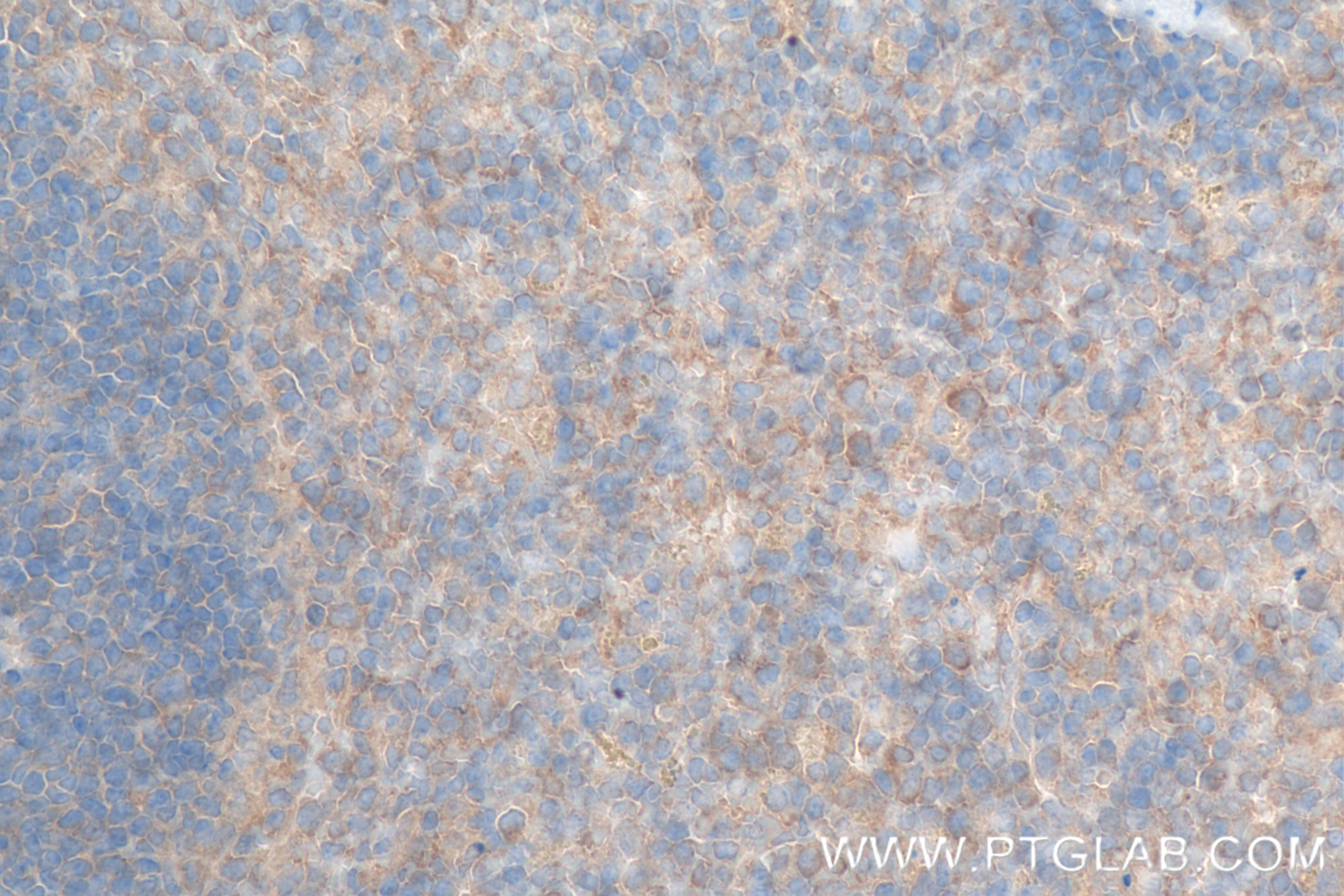 IHC staining of mouse spleen using 83884-3-RR