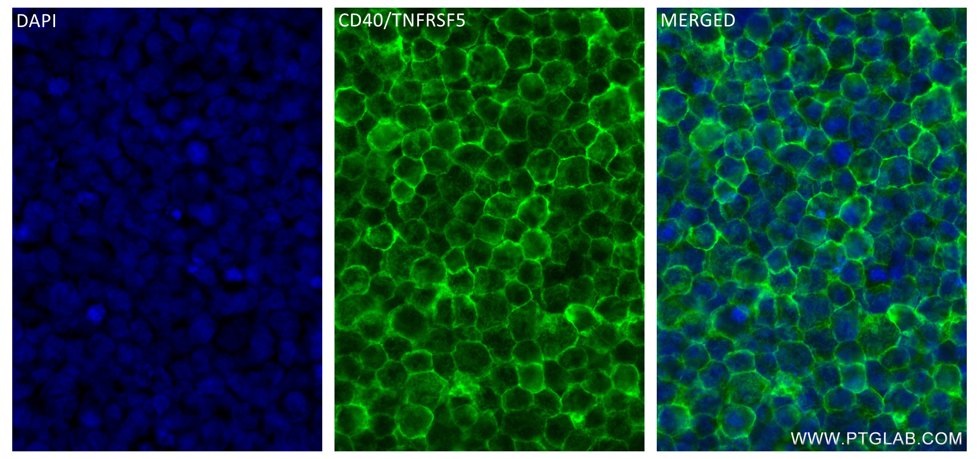 IF Staining of Raji using 84406-2-RR (same clone as 84406-2-PBS)