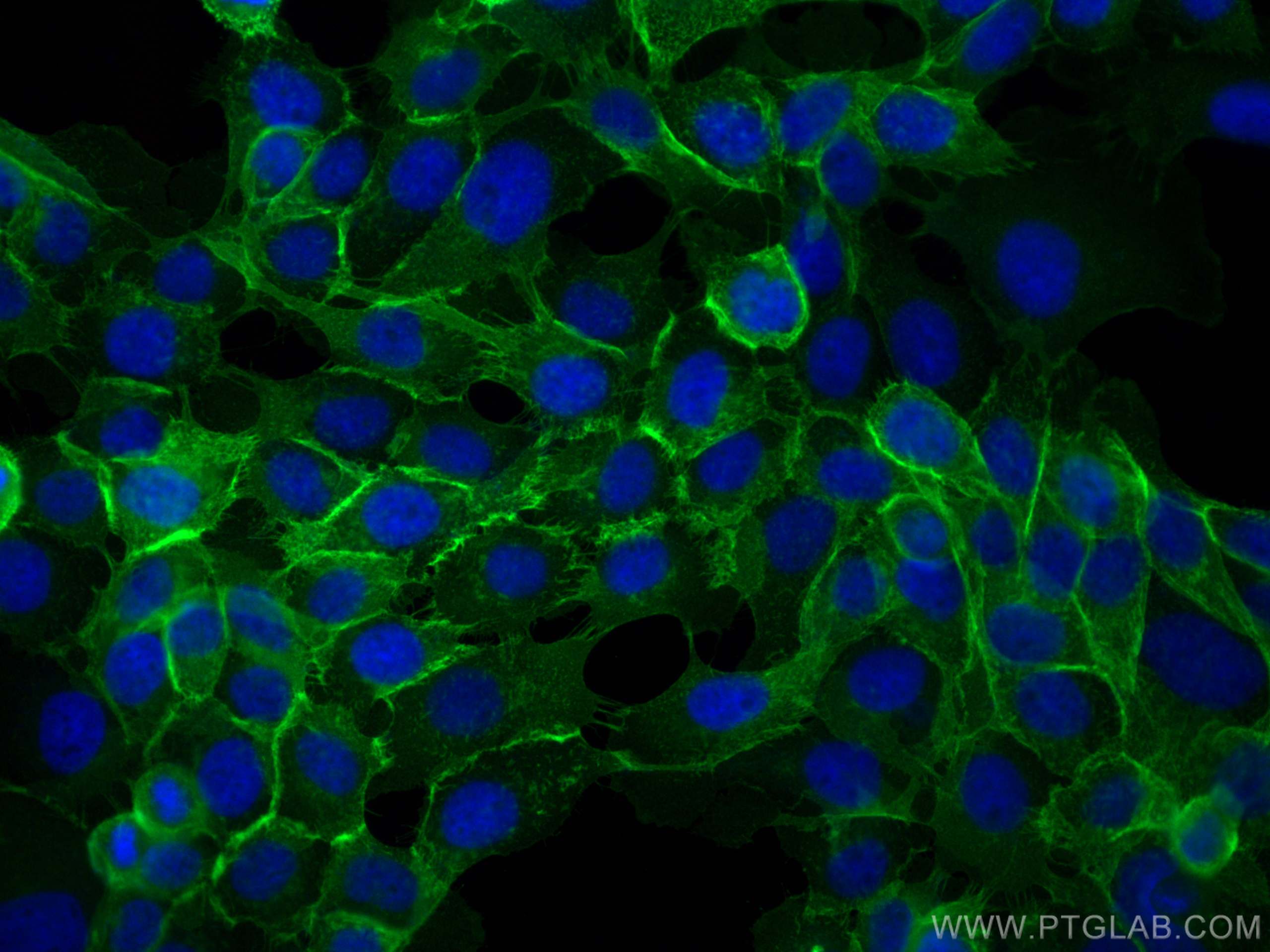 IF Staining of A431 using 60224-1-Ig