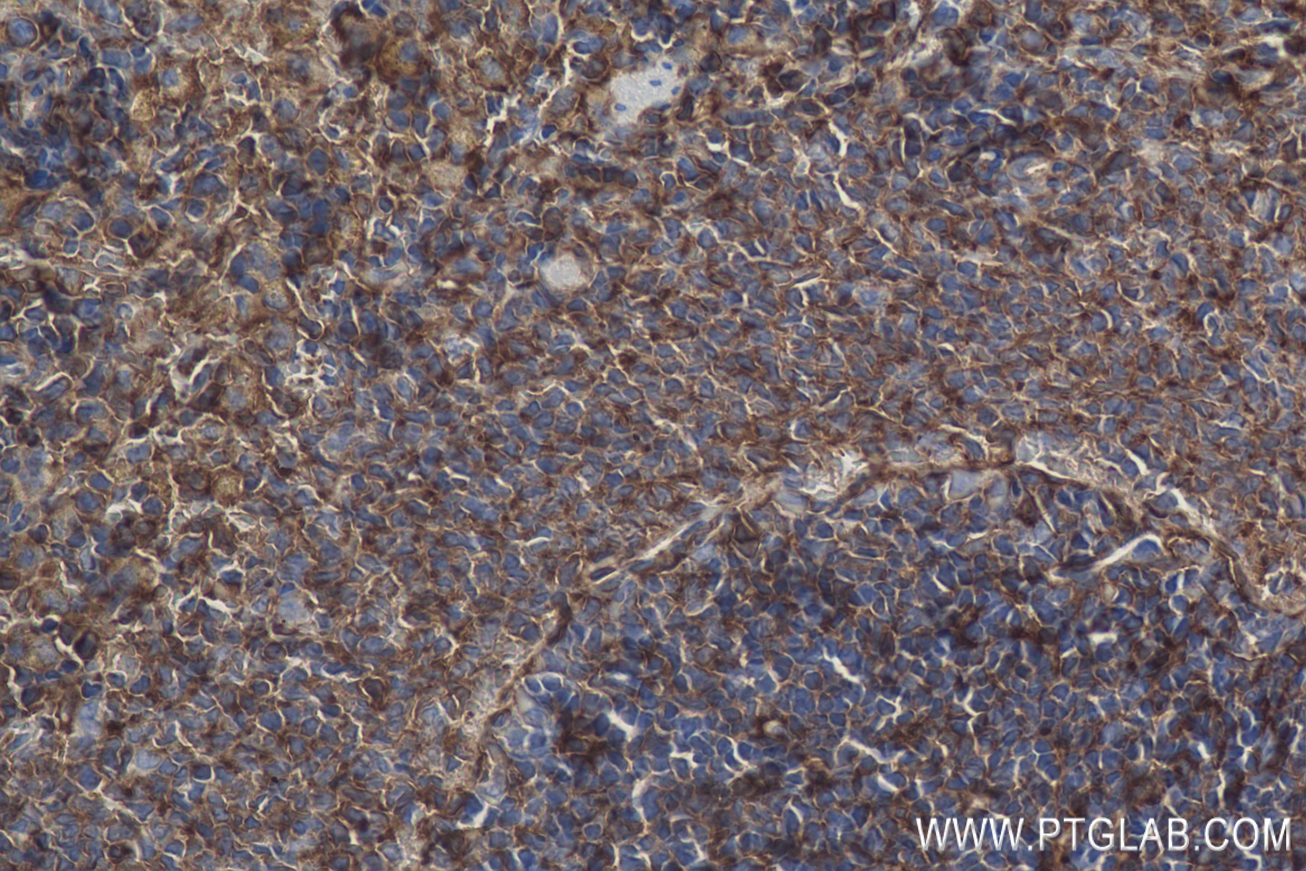 IHC staining of rat spleen using 84369-5-RR