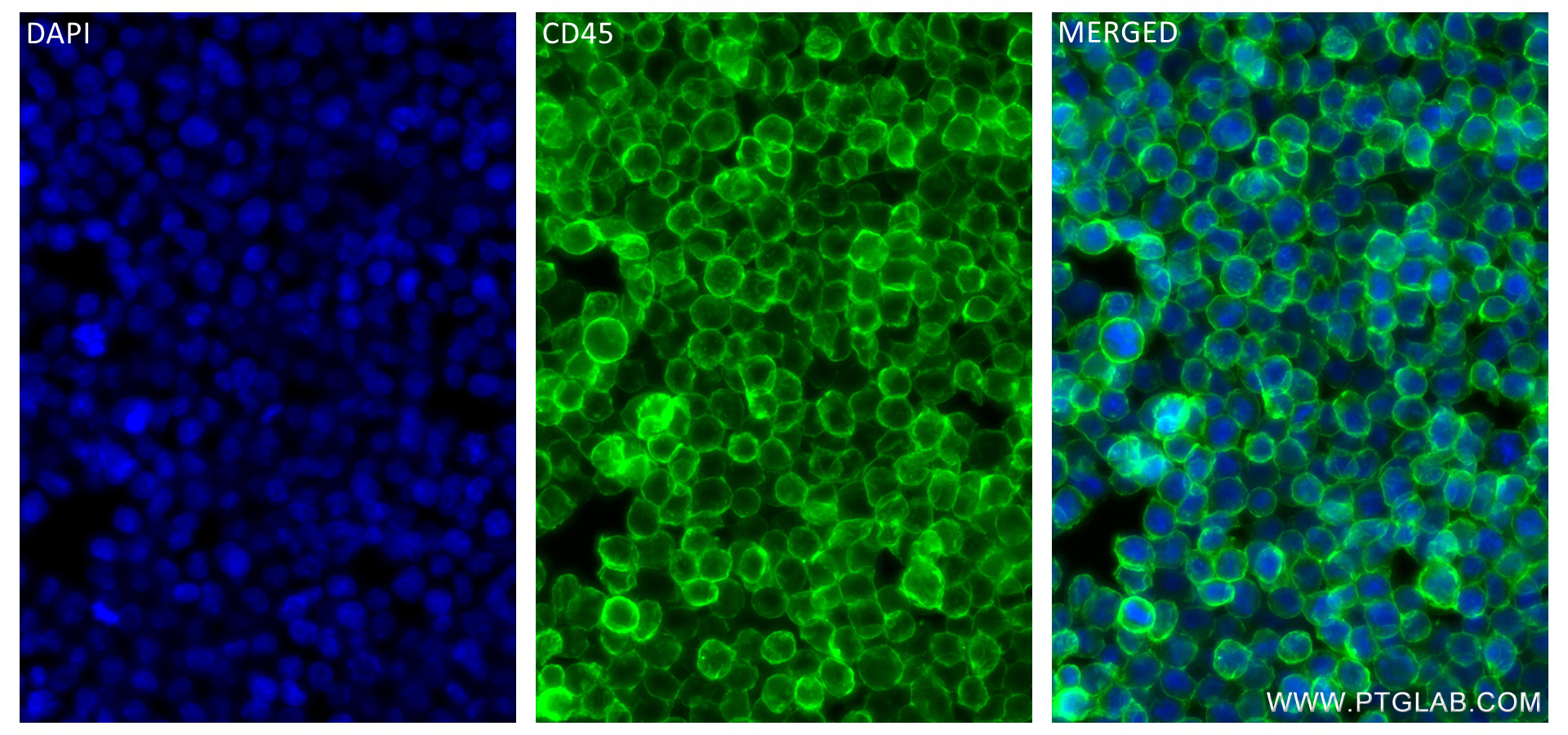 IF Staining of Jurkat using 98117-1-RR (same clone as 98117-1-PBS)