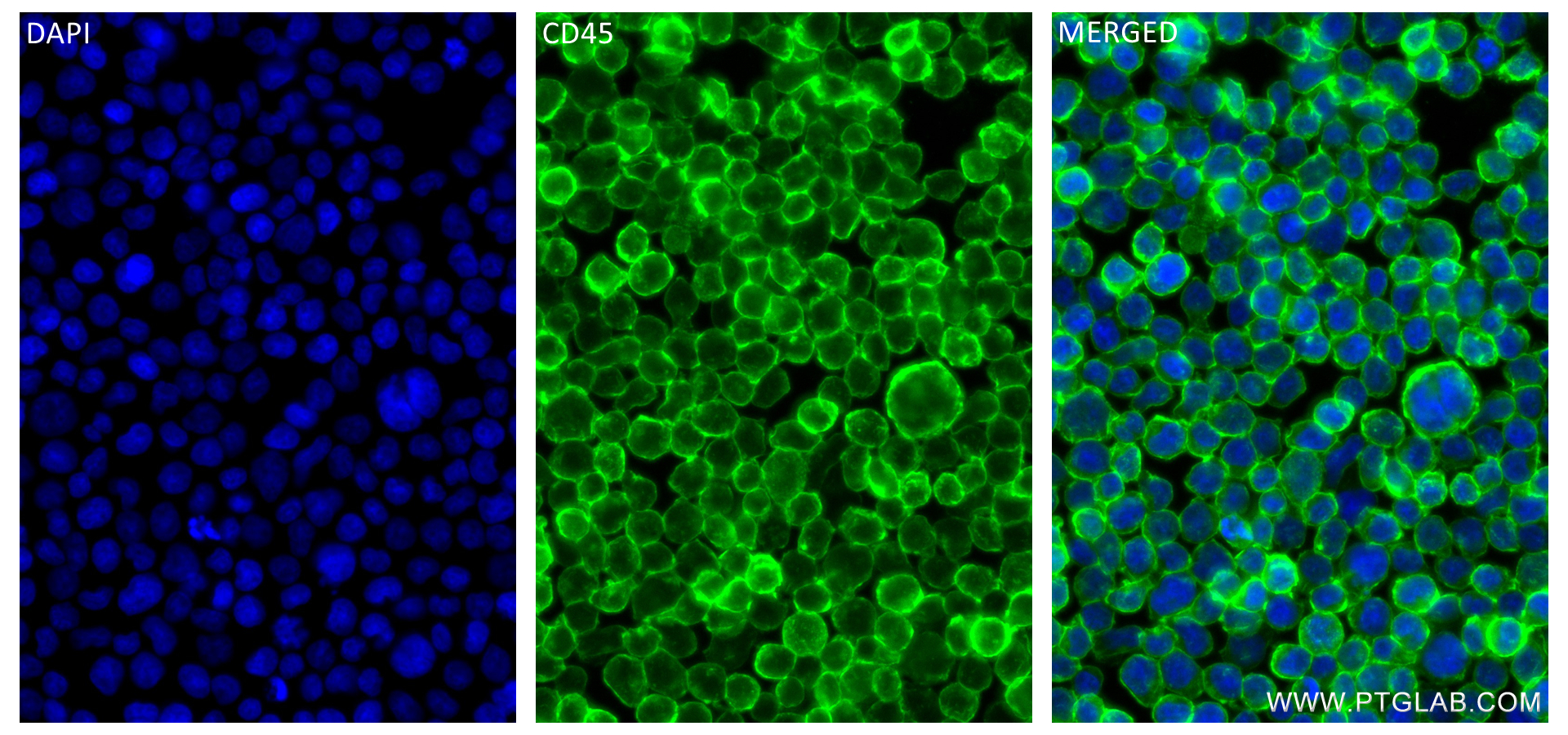 IF Staining of Jurkat using 84405-6-RR (same clone as 84405-6-PBS)