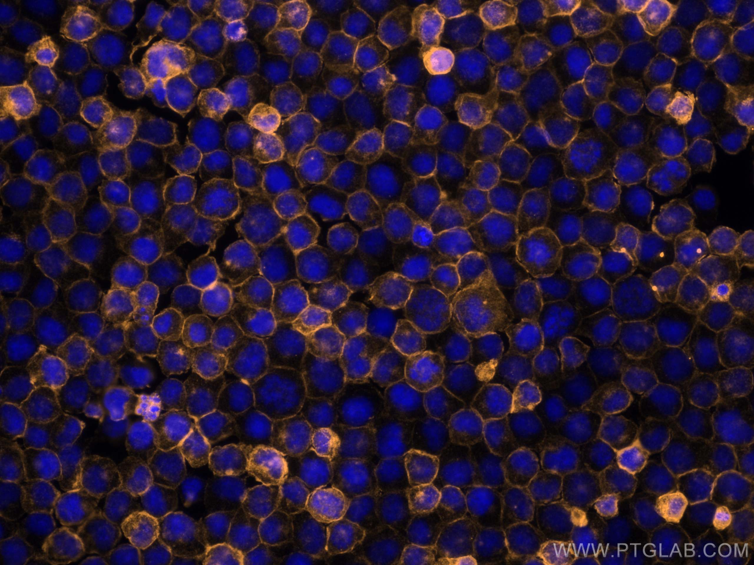 IF Staining of Jurkat using CL555-65109