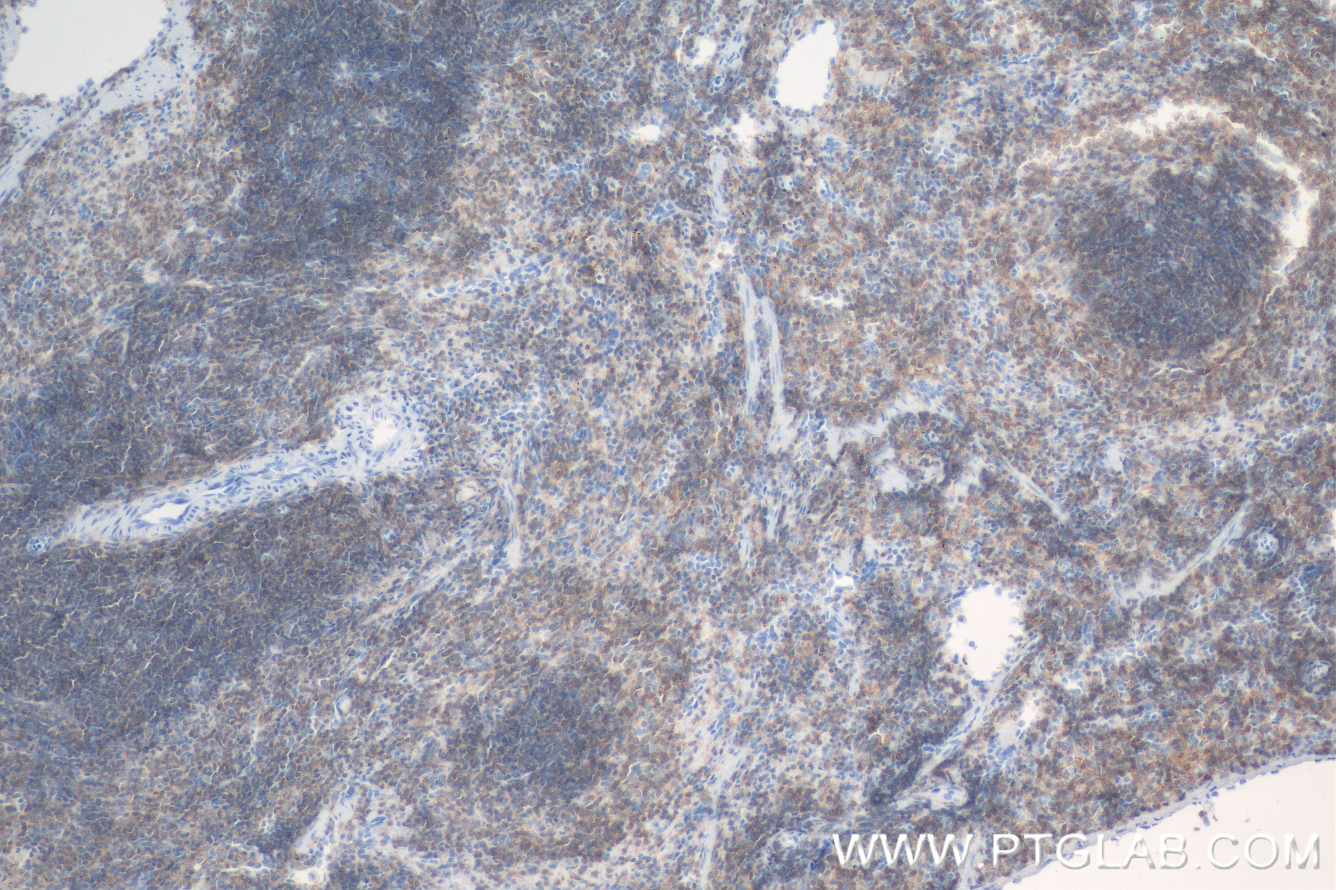 IHC staining of mouse spleen using 83396-5-RR (same clone as 83396-5-PBS)