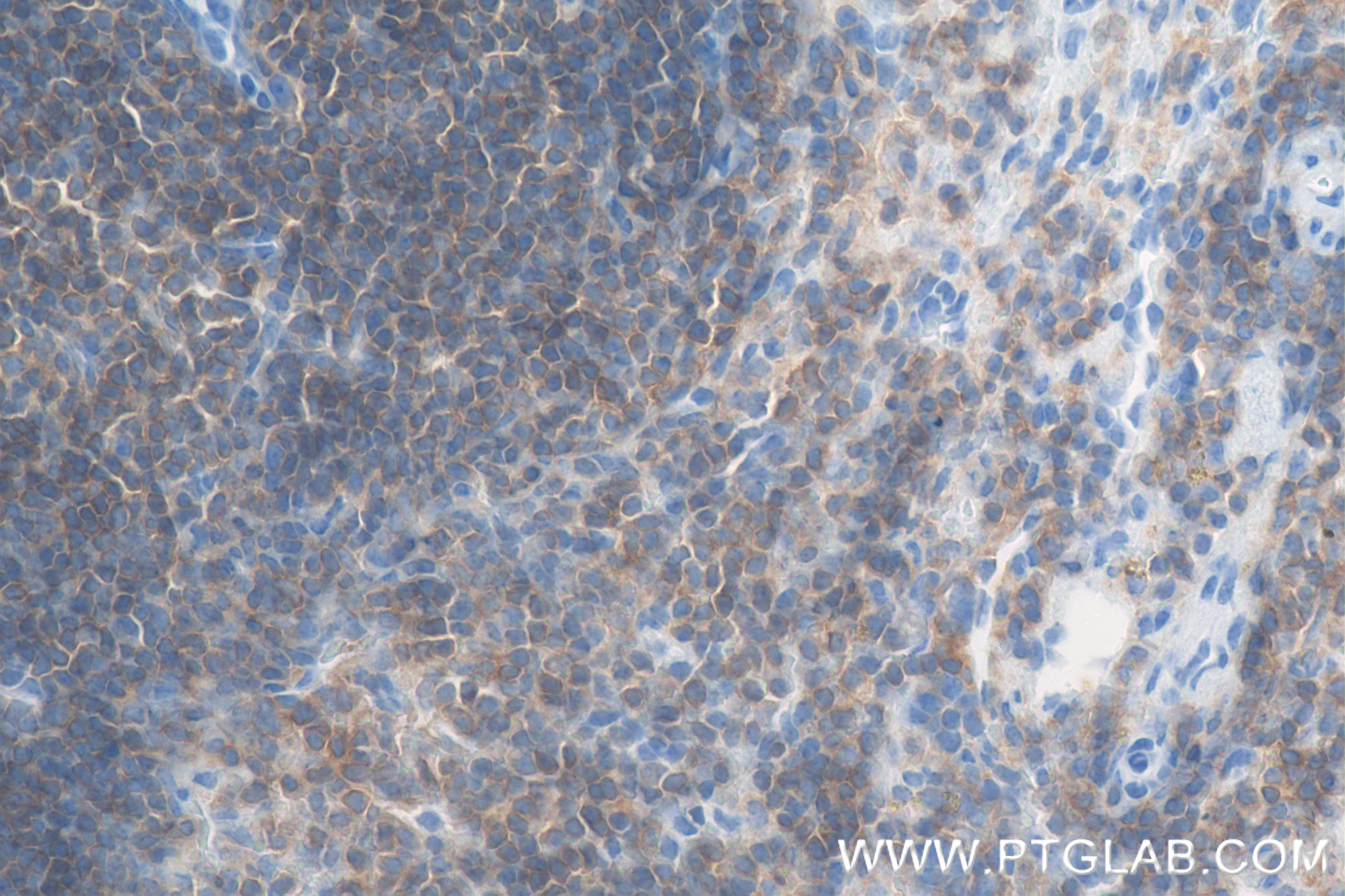 IHC staining of mouse spleen using 83396-5-RR (same clone as 83396-5-PBS)