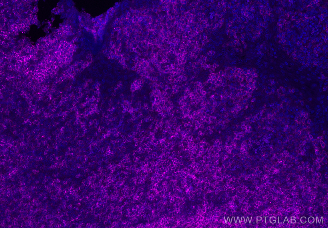 IF Staining of human tonsillitis using APC-65108