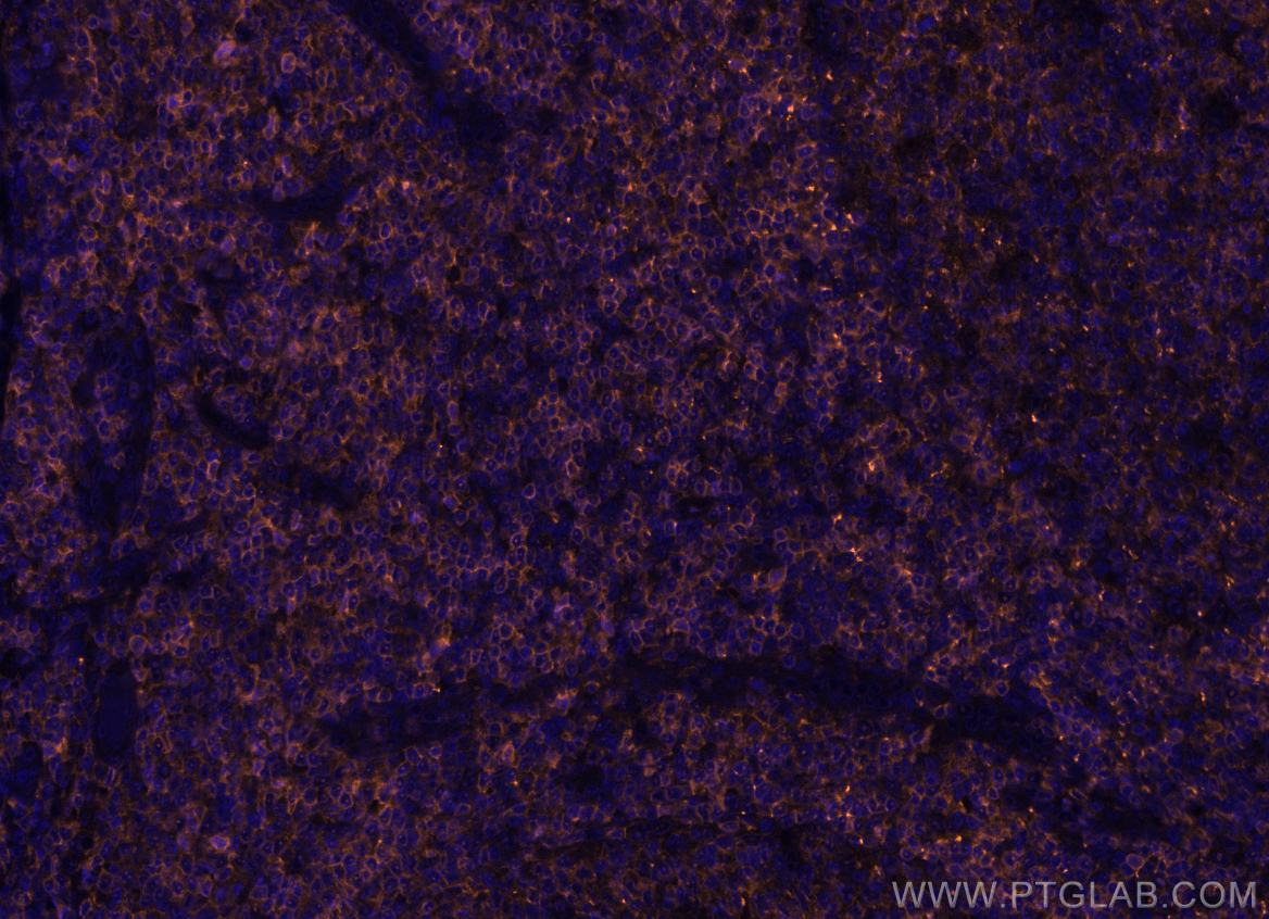 IF Staining of human tonsillitis using PE-65108