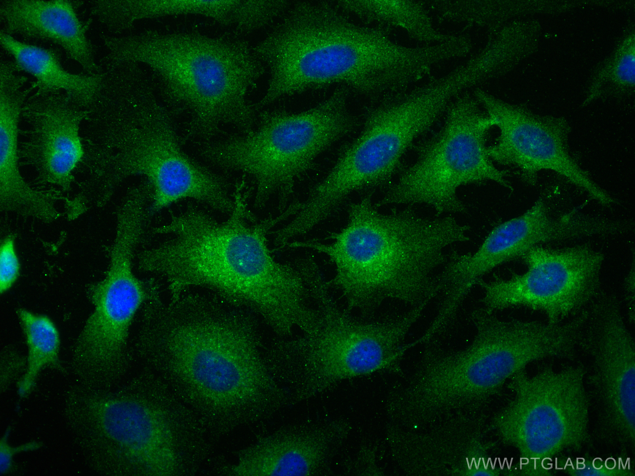 IF Staining of HeLa using 28936-1-AP