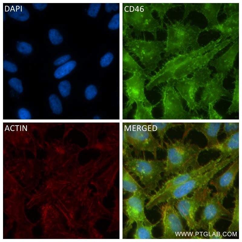 IF Staining of HeLa using 84599-5-RR