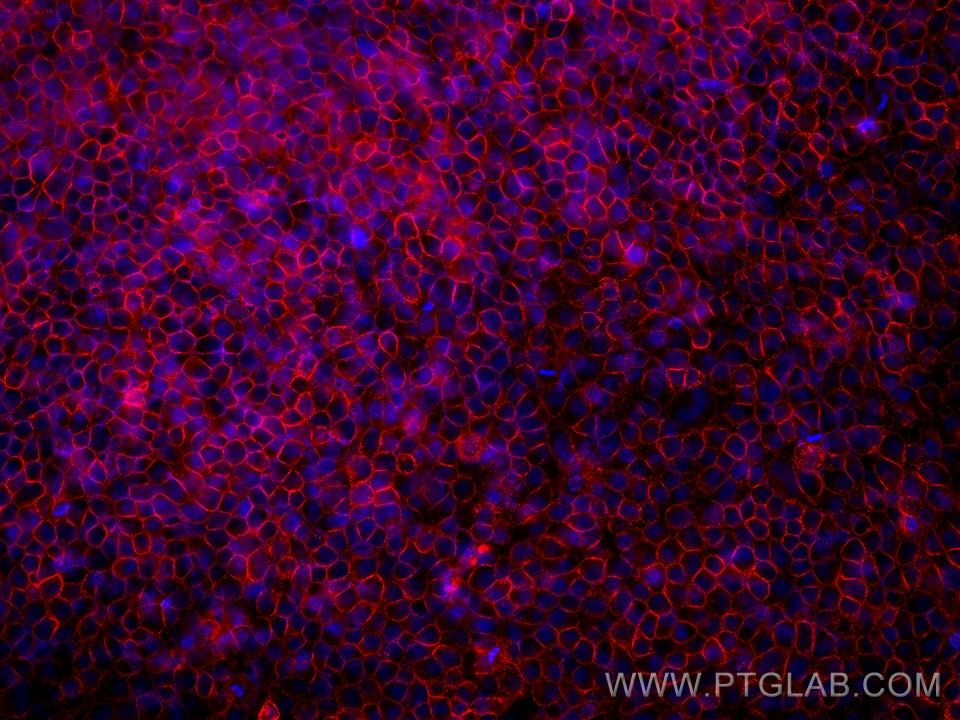 IF Staining of HepG2 using 60551-1-Ig (same clone as 60551-1-PBS)