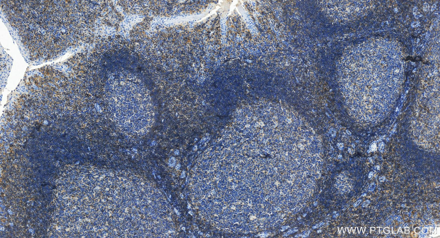 IHC staining of human tonsillitis using 27519-1-AP