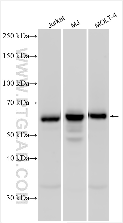 WB analysis using 31502-1-AP (same clone as 31502-1-PBS)