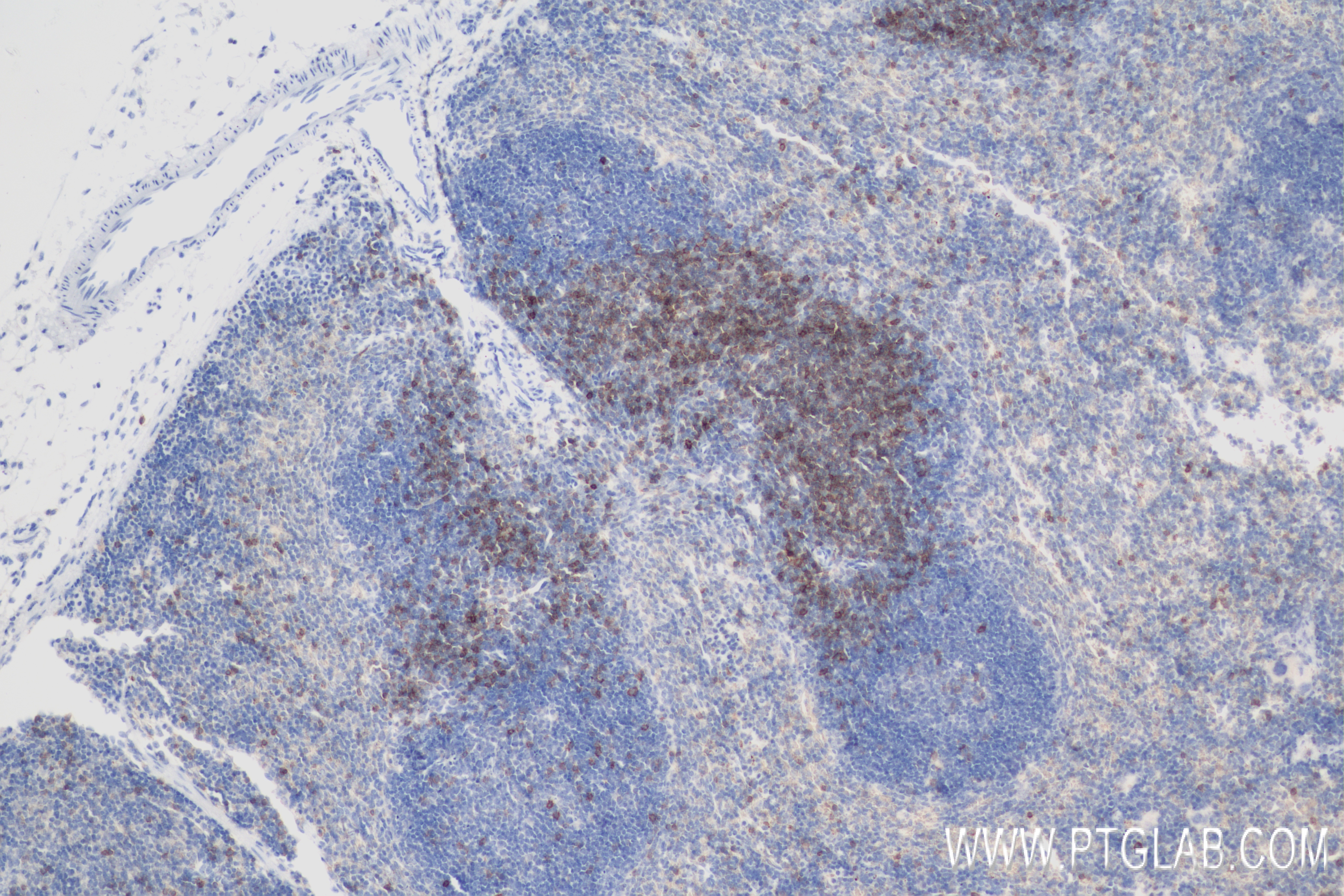 IHC staining of mouse spleen using 83451-4-RR (same clone as 83451-4-PBS)