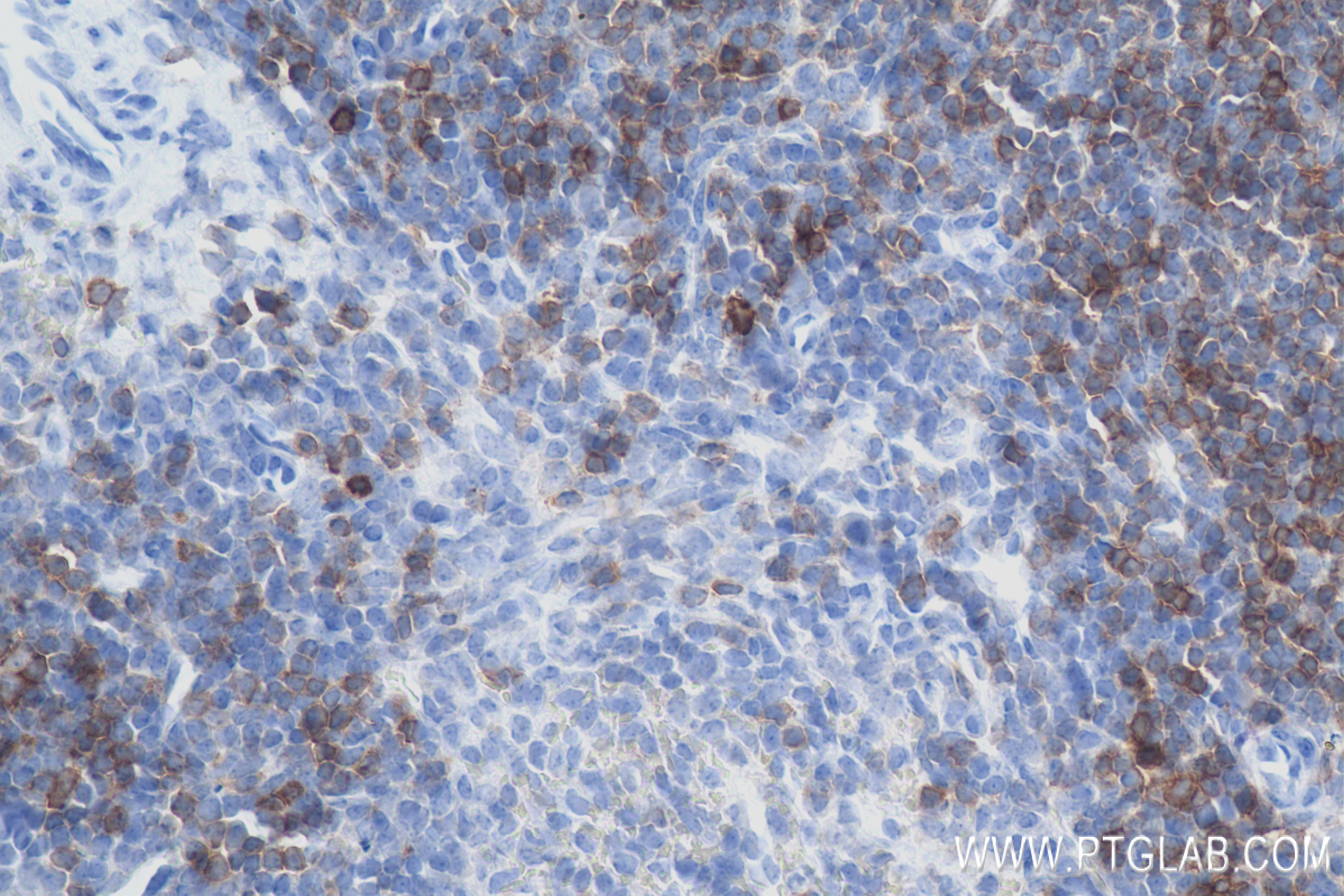 IHC staining of mouse spleen using 83451-4-RR (same clone as 83451-4-PBS)