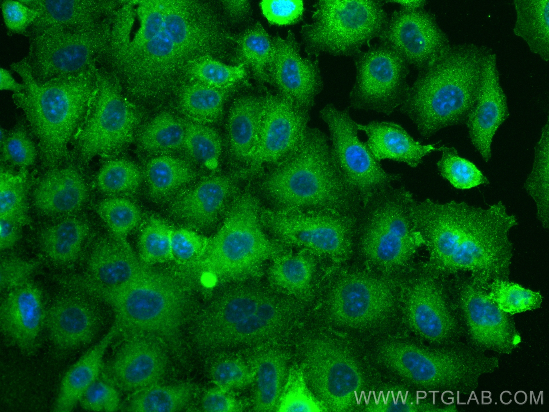 IF Staining of A549 using 82781-6-RR (same clone as 82781-6-PBS)