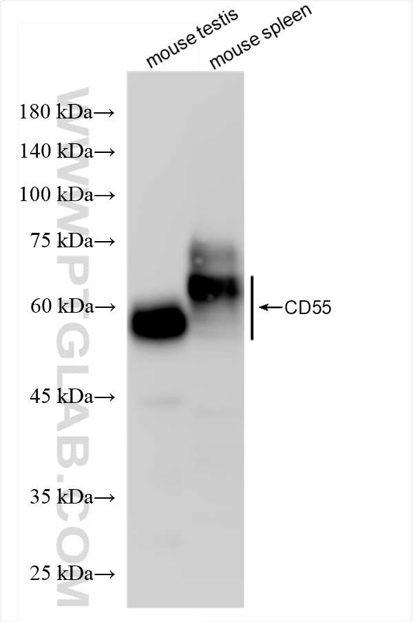 WB analysis using 84519-4-RR