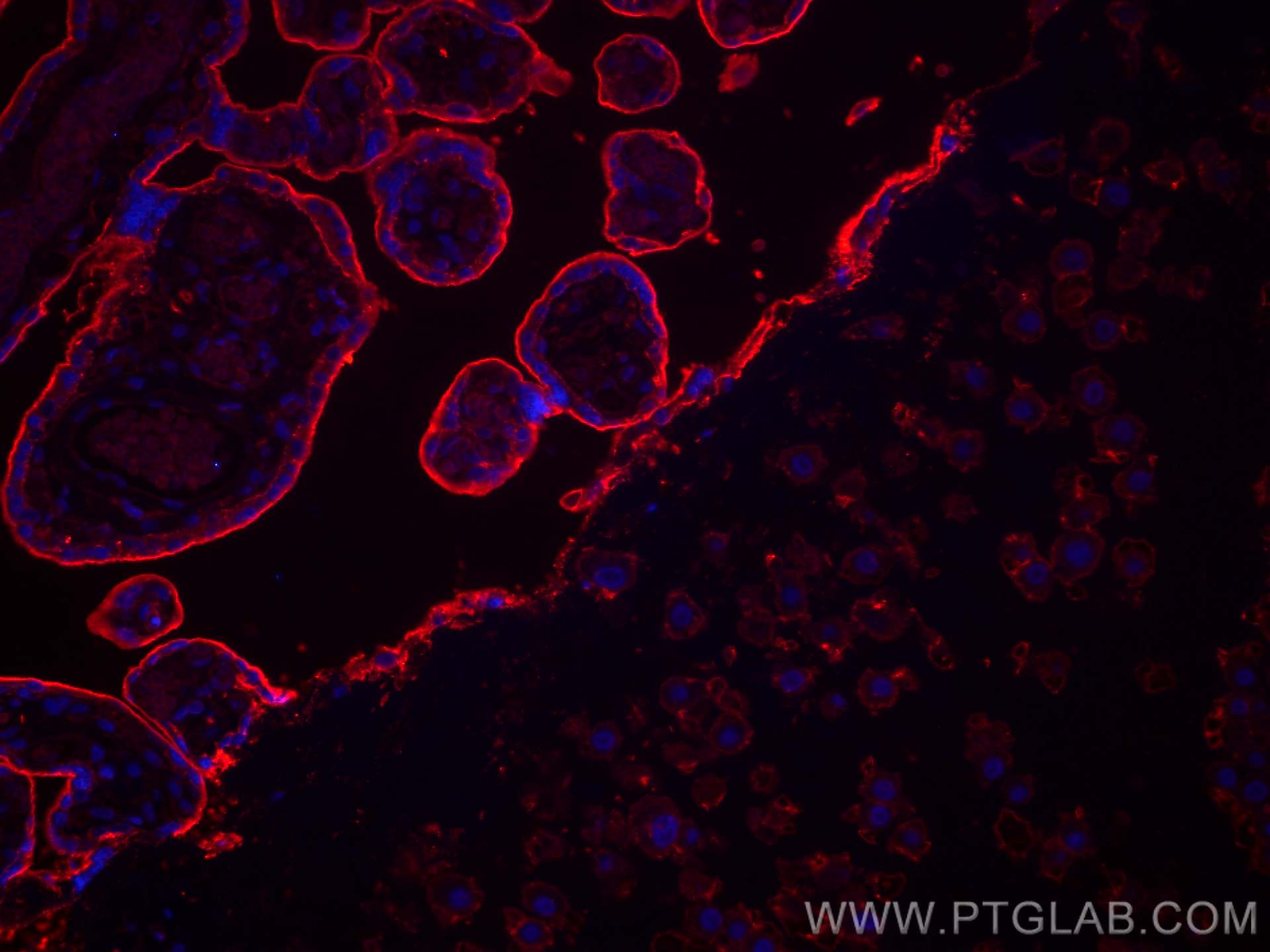 IF Staining of human placenta using 68222-1-Ig (same clone as 68222-1-PBS)
