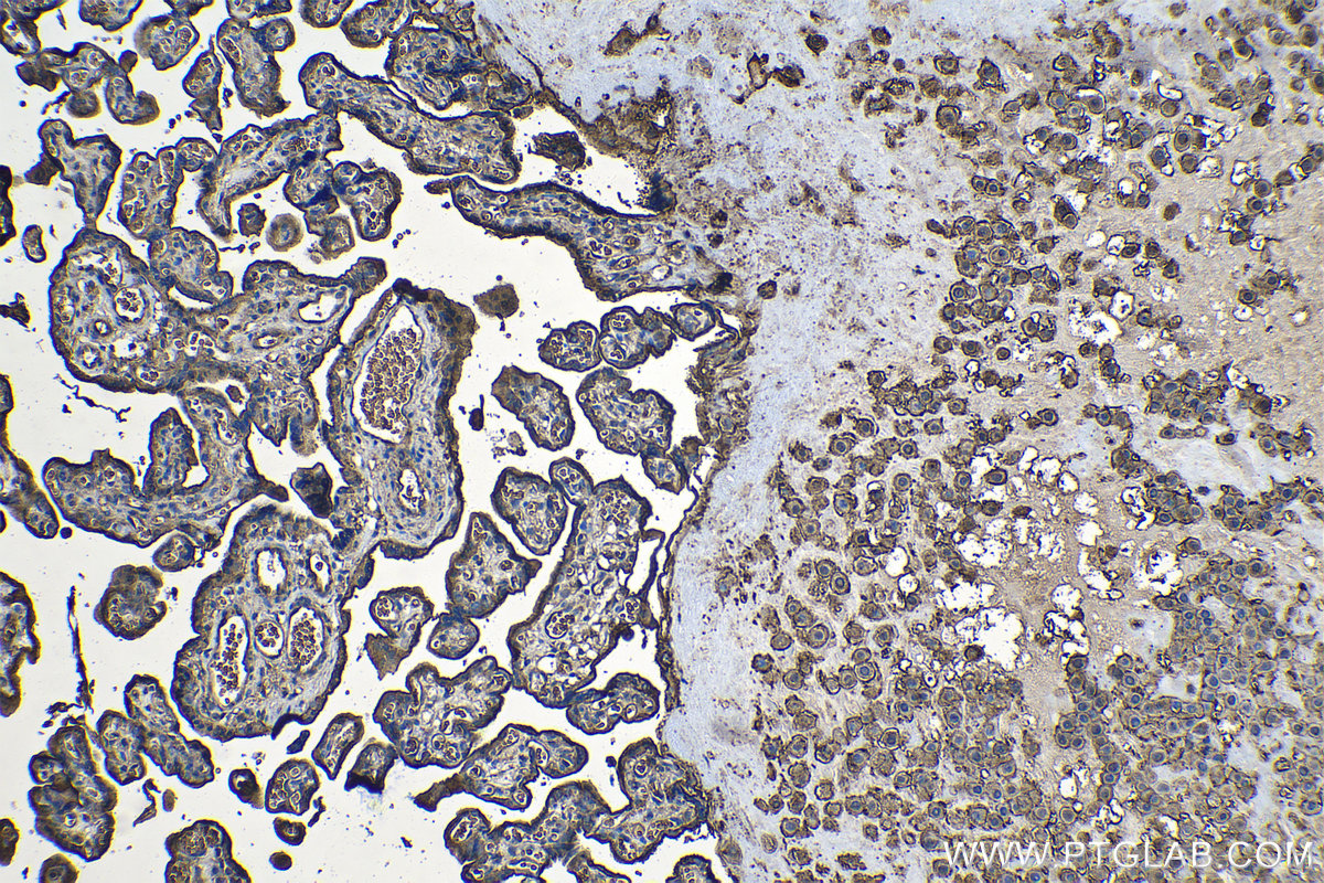 IHC staining of human placenta using 68222-1-Ig (same clone as 68222-1-PBS)