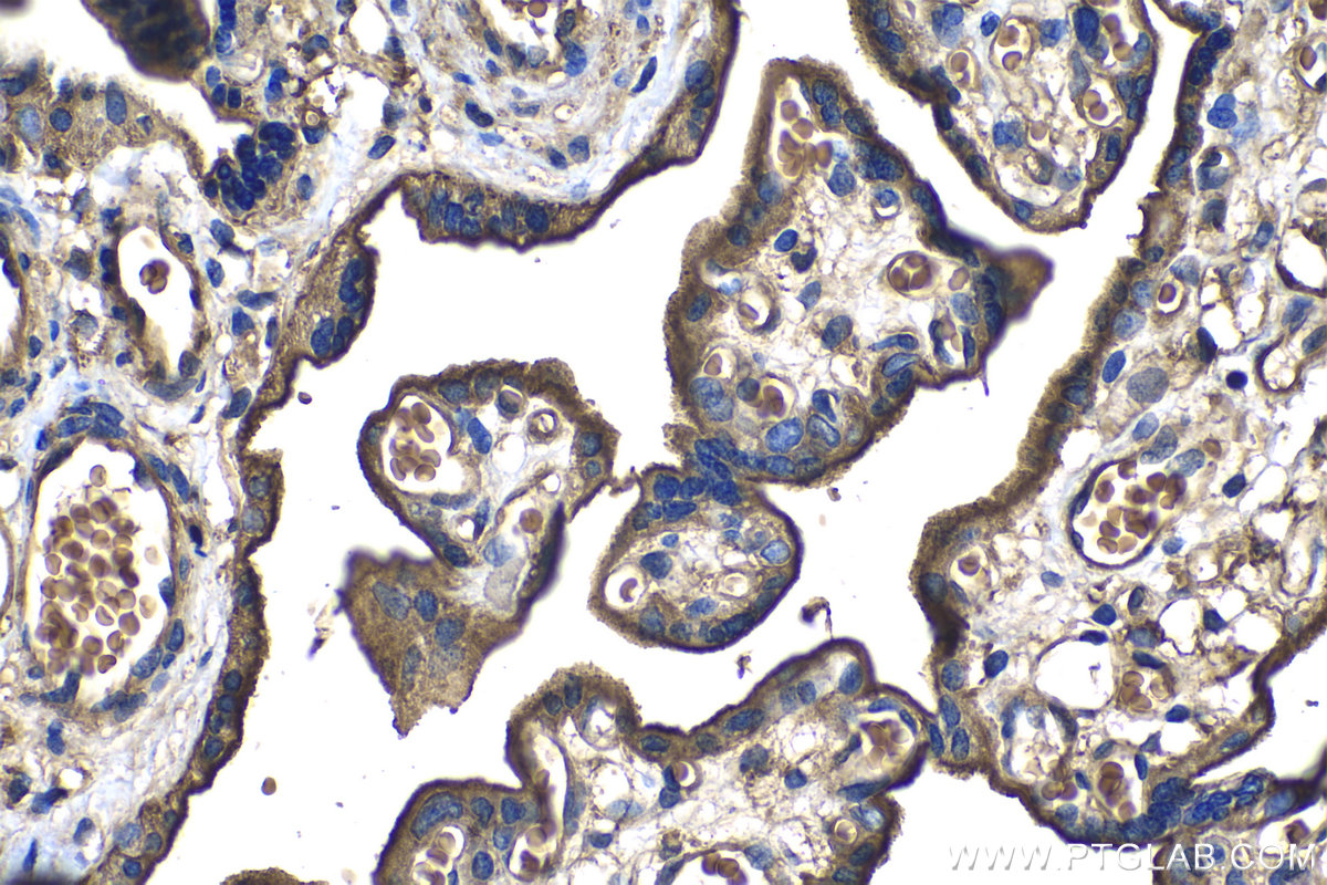 IHC staining of human placenta using 68222-1-Ig (same clone as 68222-1-PBS)