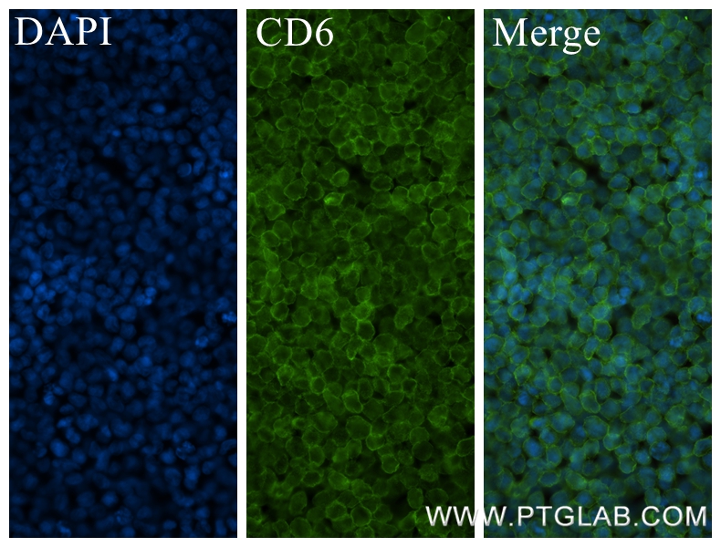 IF Staining of MOLT-4 using 84508-4-RR (same clone as 84508-4-PBS)