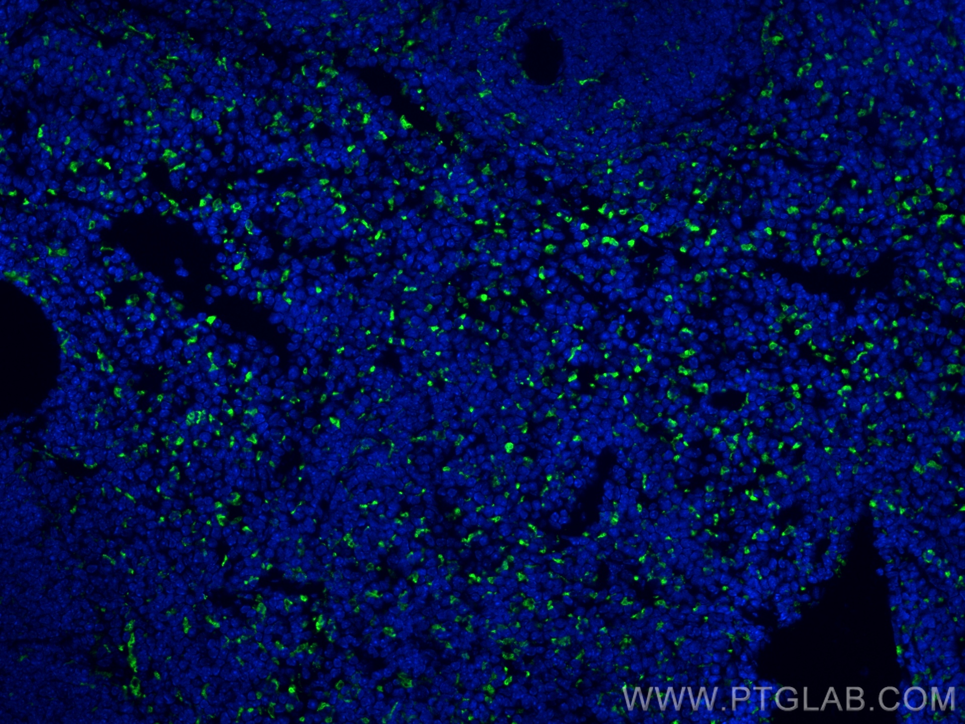 IF Staining of mouse spleen using 83014-5-RR (same clone as 83014-5-PBS)