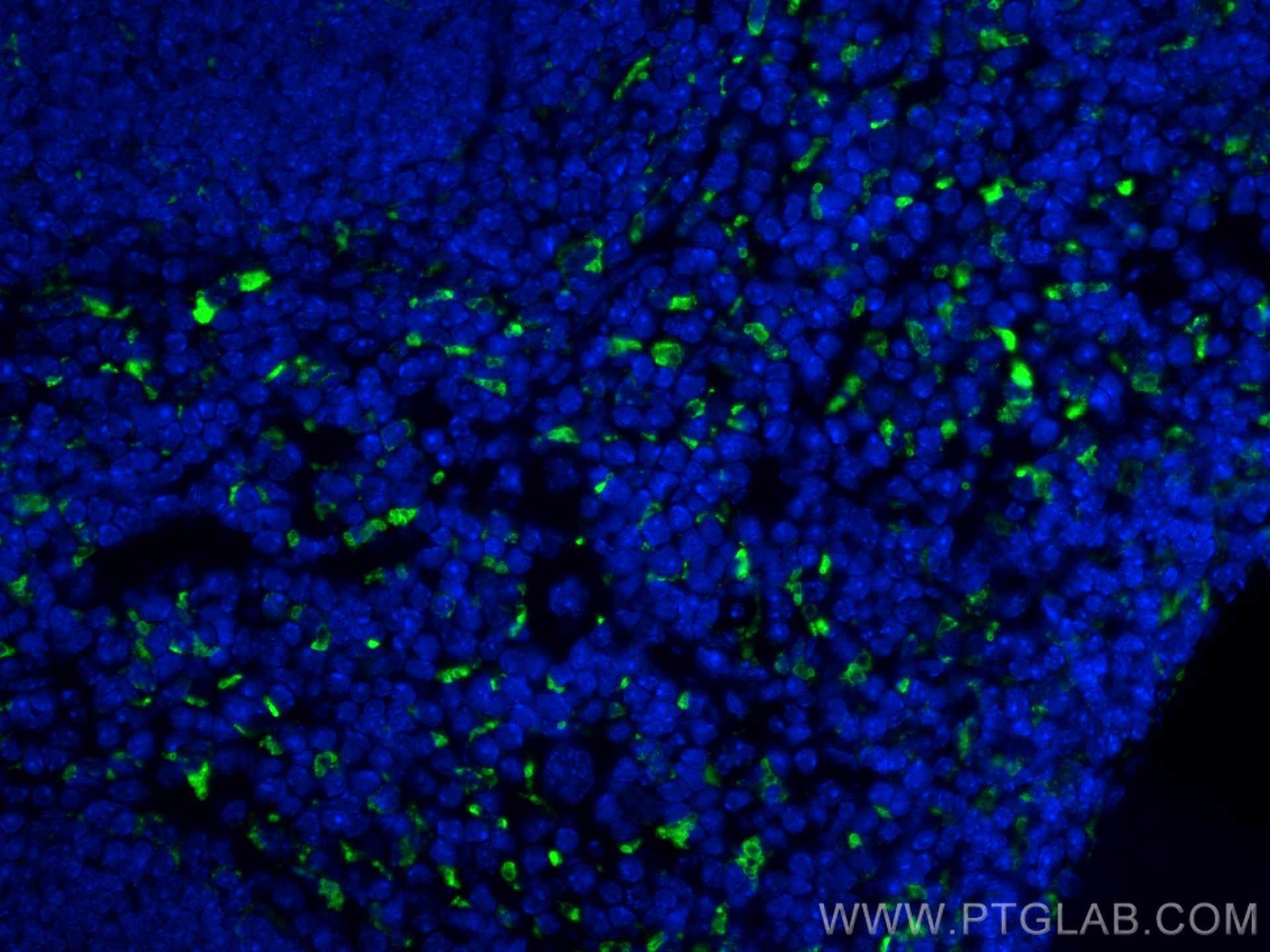 IF Staining of mouse spleen using 83014-5-RR (same clone as 83014-5-PBS)