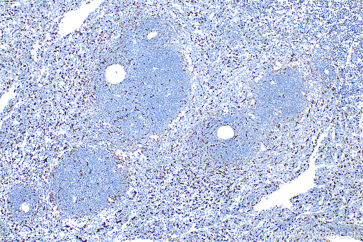 IHC staining of mouse spleen using 83014-5-RR (same clone as 83014-5-PBS)