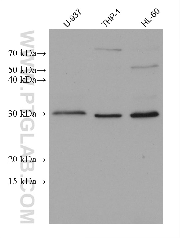 WB analysis using 68827-1-Ig