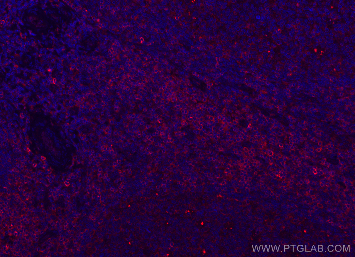 IF Staining of human tonsillitis using CL594-60209