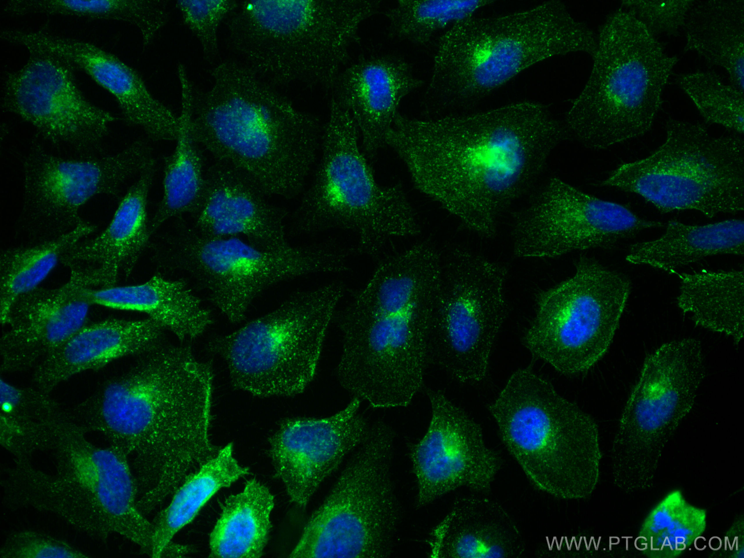 IF Staining of HeLa using 30574-1-AP