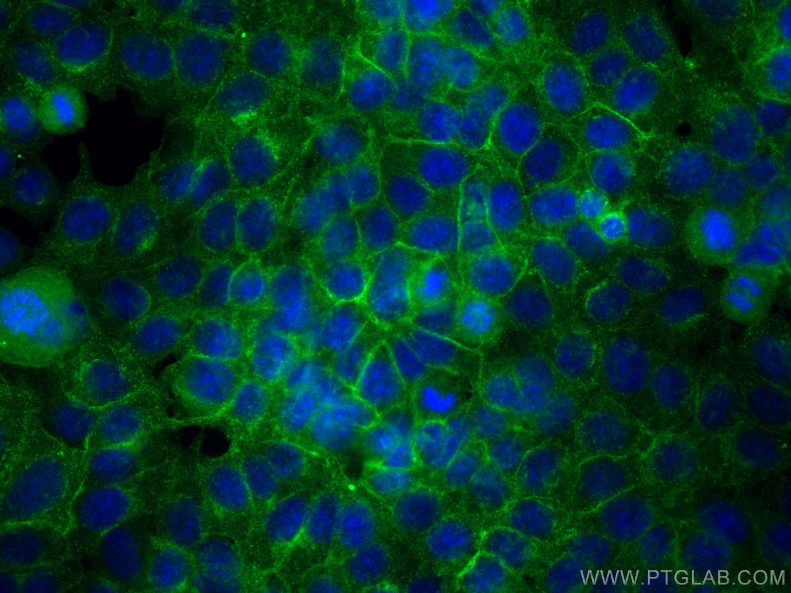 IF Staining of MCF-7 using 30574-1-AP