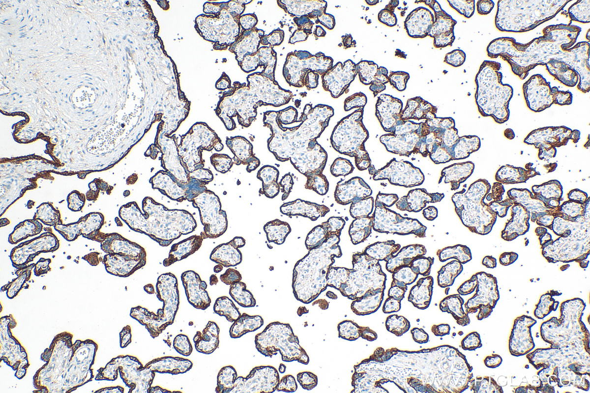 IHC staining of human placenta using 30574-1-AP