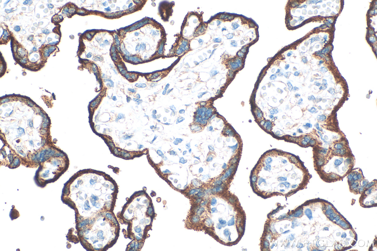 IHC staining of human placenta using 30574-1-AP