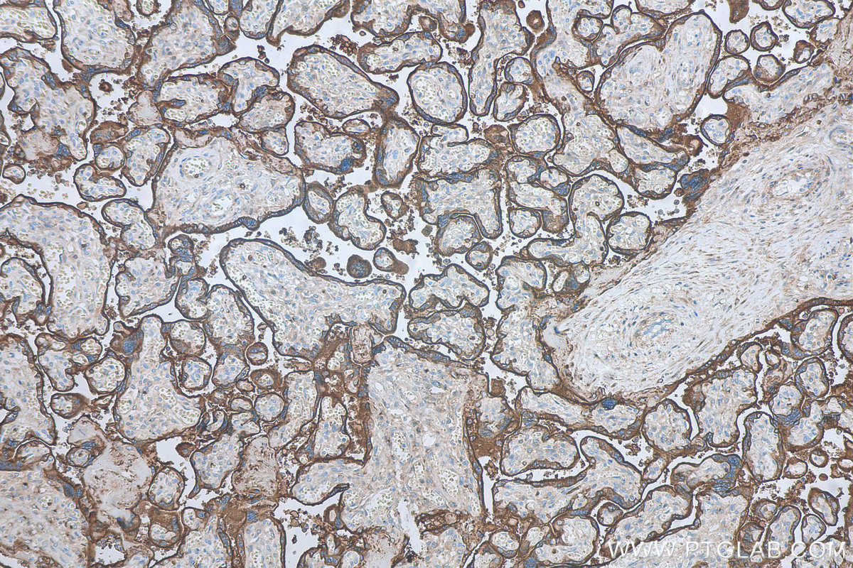 IHC staining of human placenta using 66180-1-Ig (same clone as 66180-1-PBS)