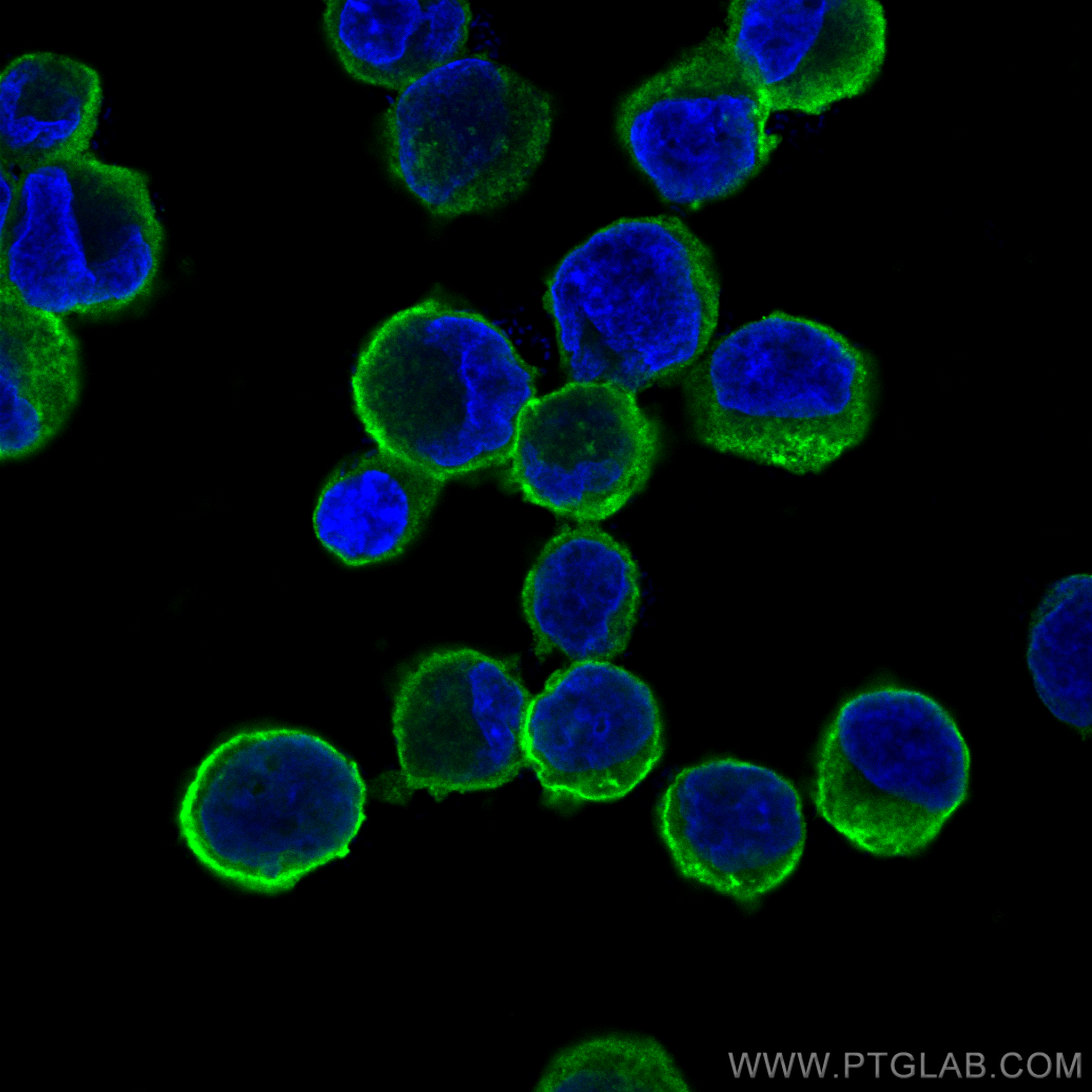 IF Staining of K-562 using 81793-2-RR (same clone as 81793-2-PBS)