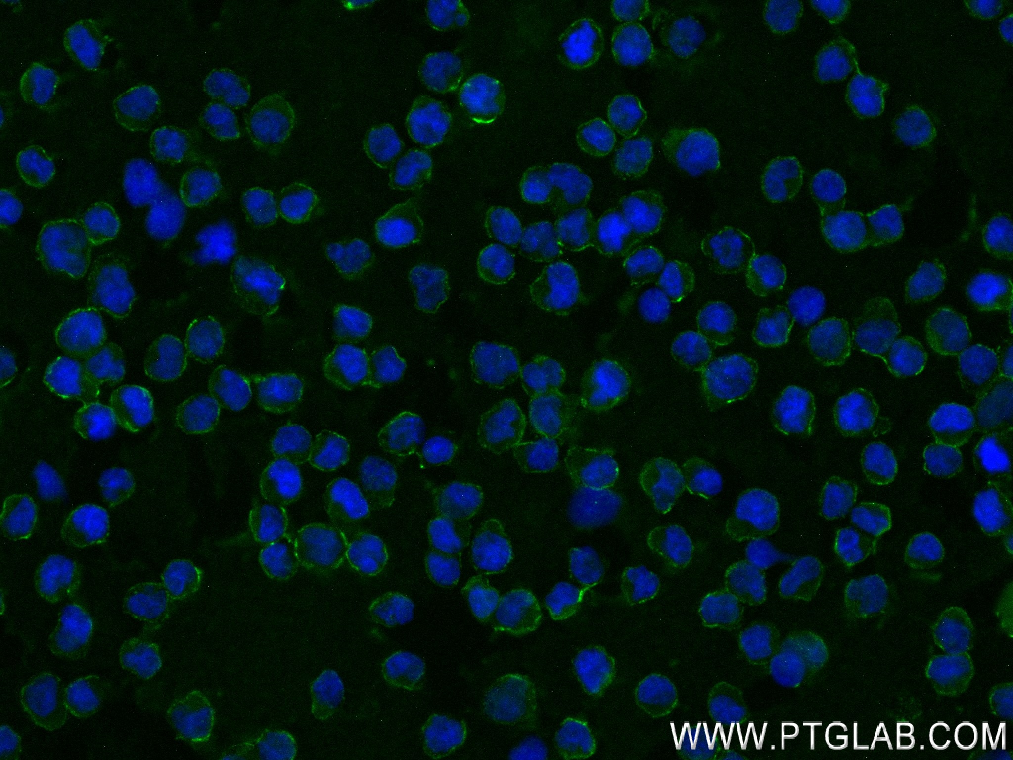 IF Staining of Raji using 82747-2-RR (same clone as 82747-2-PBS)