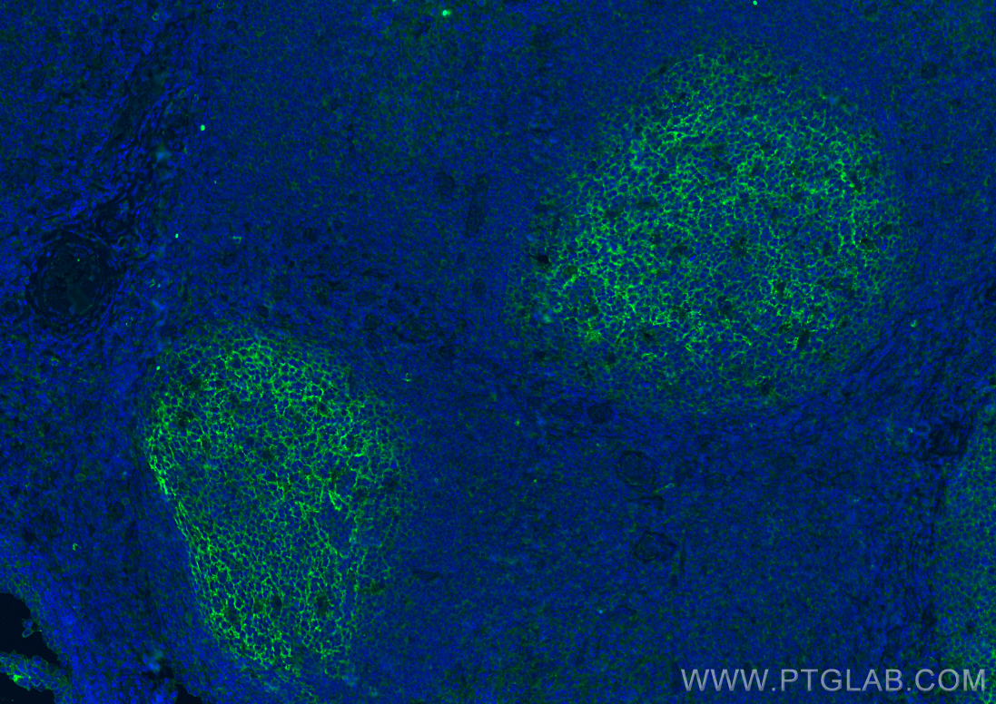 IF Staining of human tonsillitis using 66803-1-Ig (same clone as 66803-1-PBS)