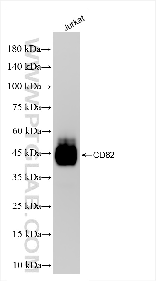 WB analysis of Jurkat using 84617-7-RR (same clone as 84617-7-PBS)