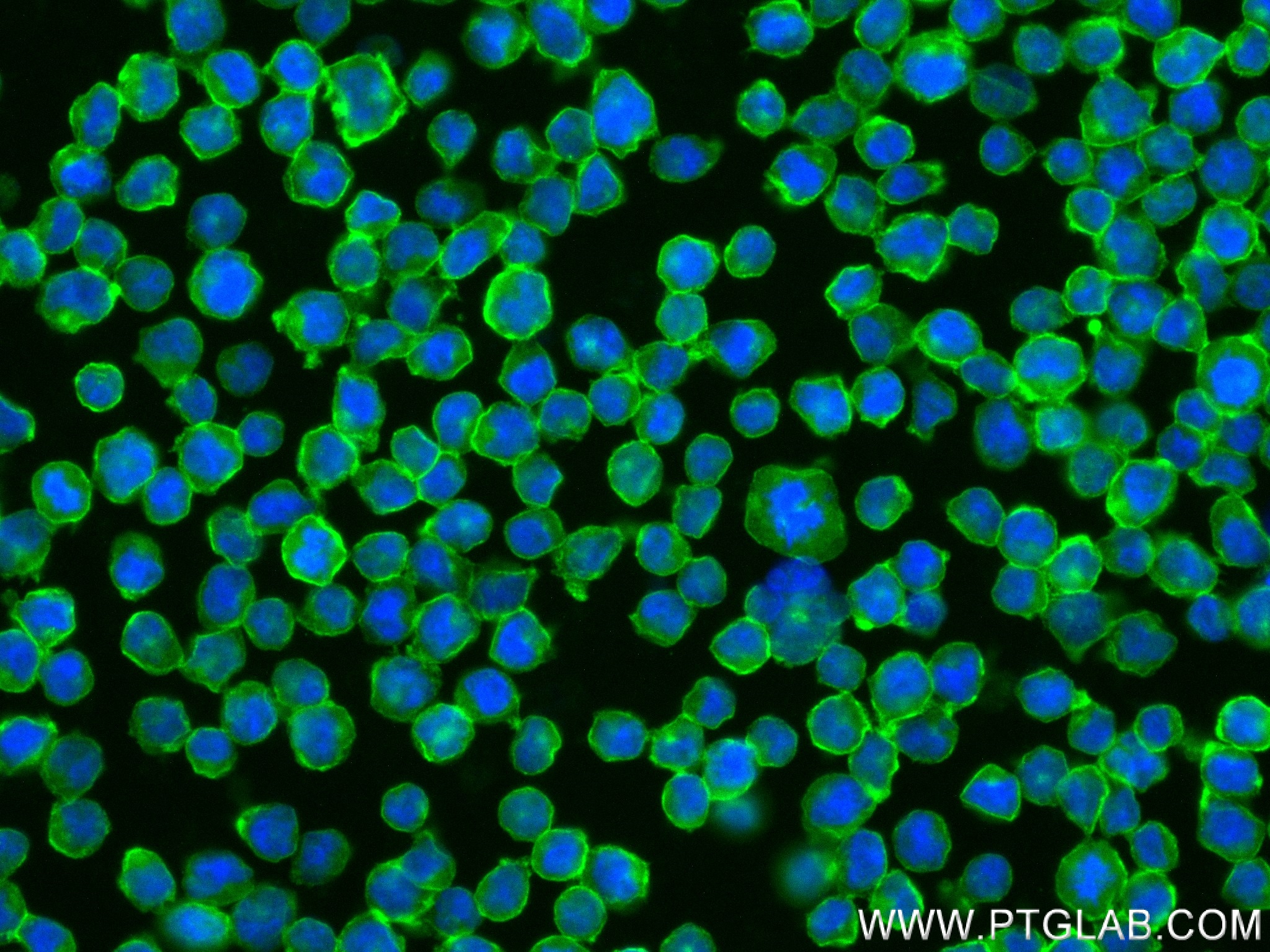 IF Staining of Raji using 84245-2-RR (same clone as 84245-2-PBS)