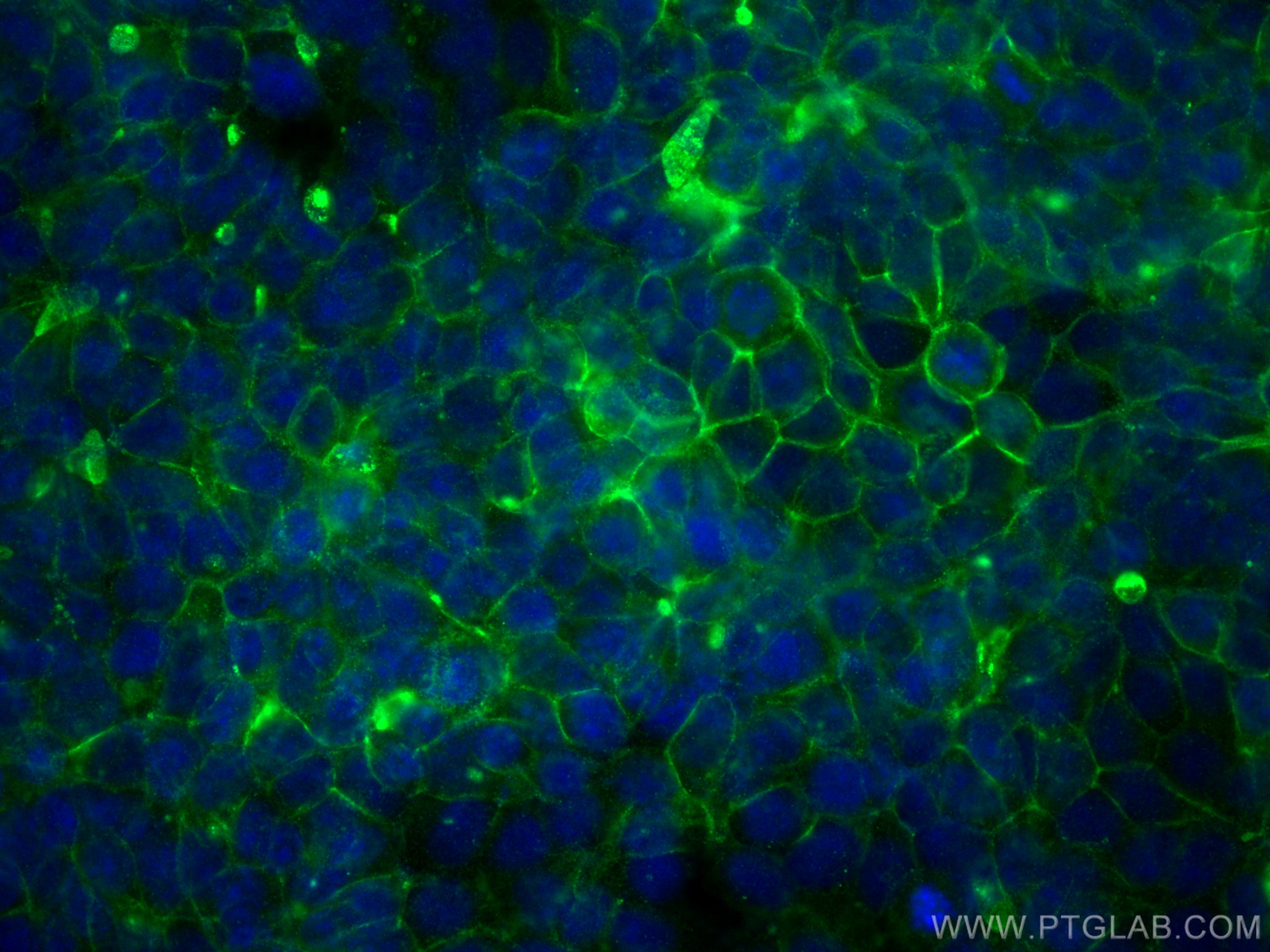 IF Staining of MCF-7 using 31514-1-AP