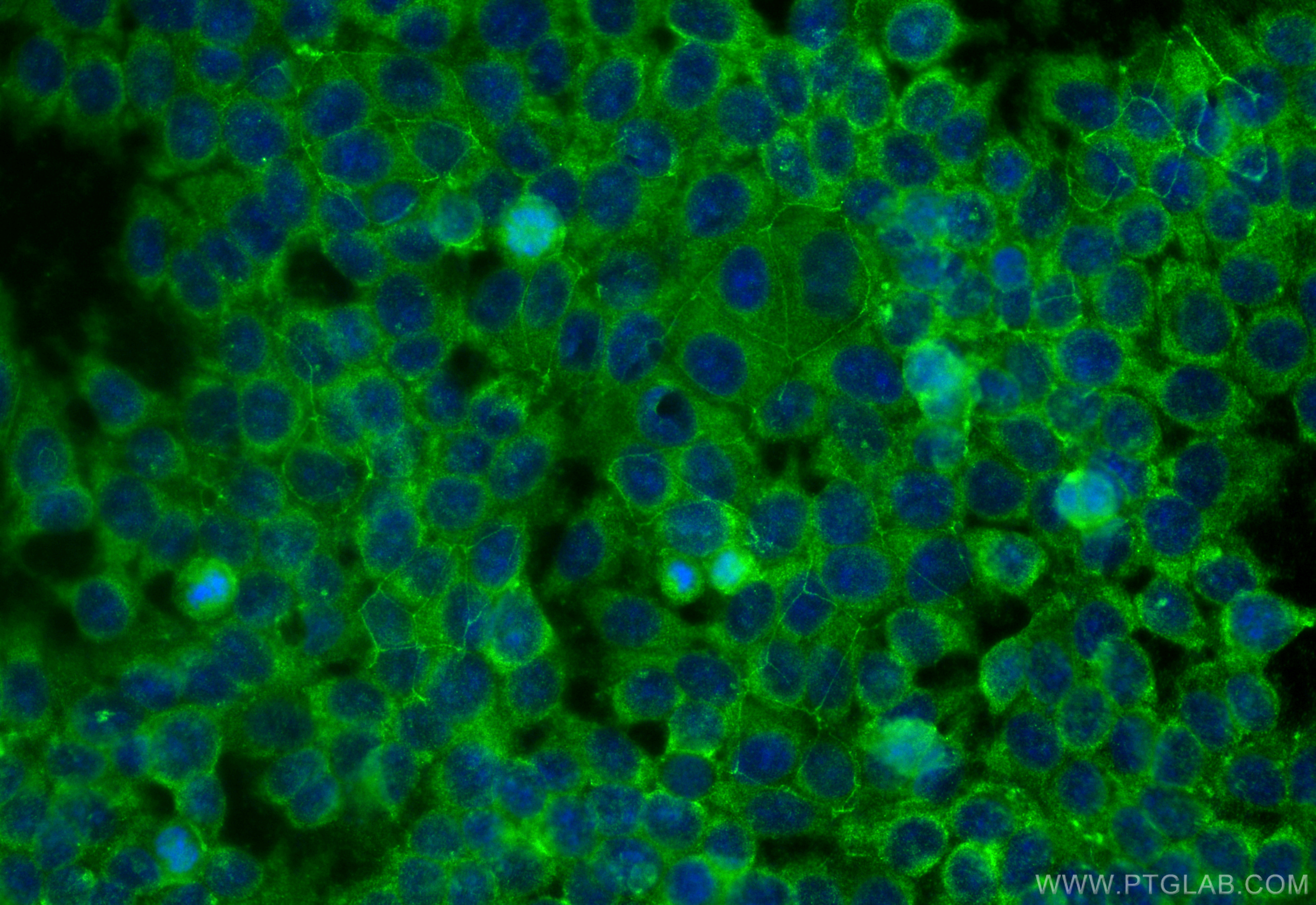 IF Staining of MCF-7 using 60232-1-Ig (same clone as 60232-1-PBS)