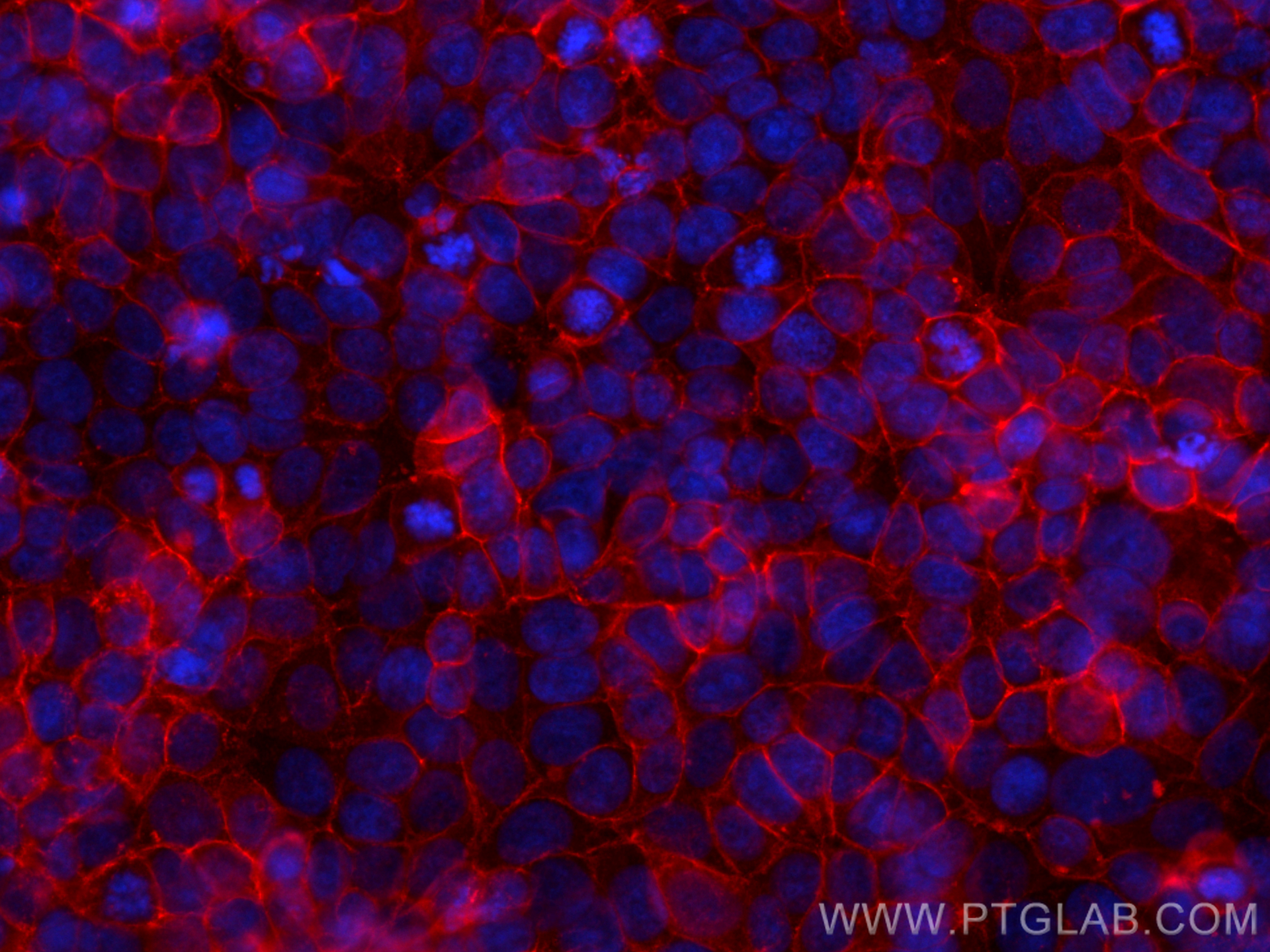 IF Staining of MCF-7 using 82105-1-RR (same clone as 82105-1-PBS)