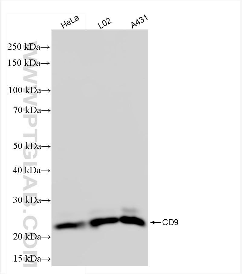 WB analysis using 82105-1-RR (same clone as 82105-1-PBS)