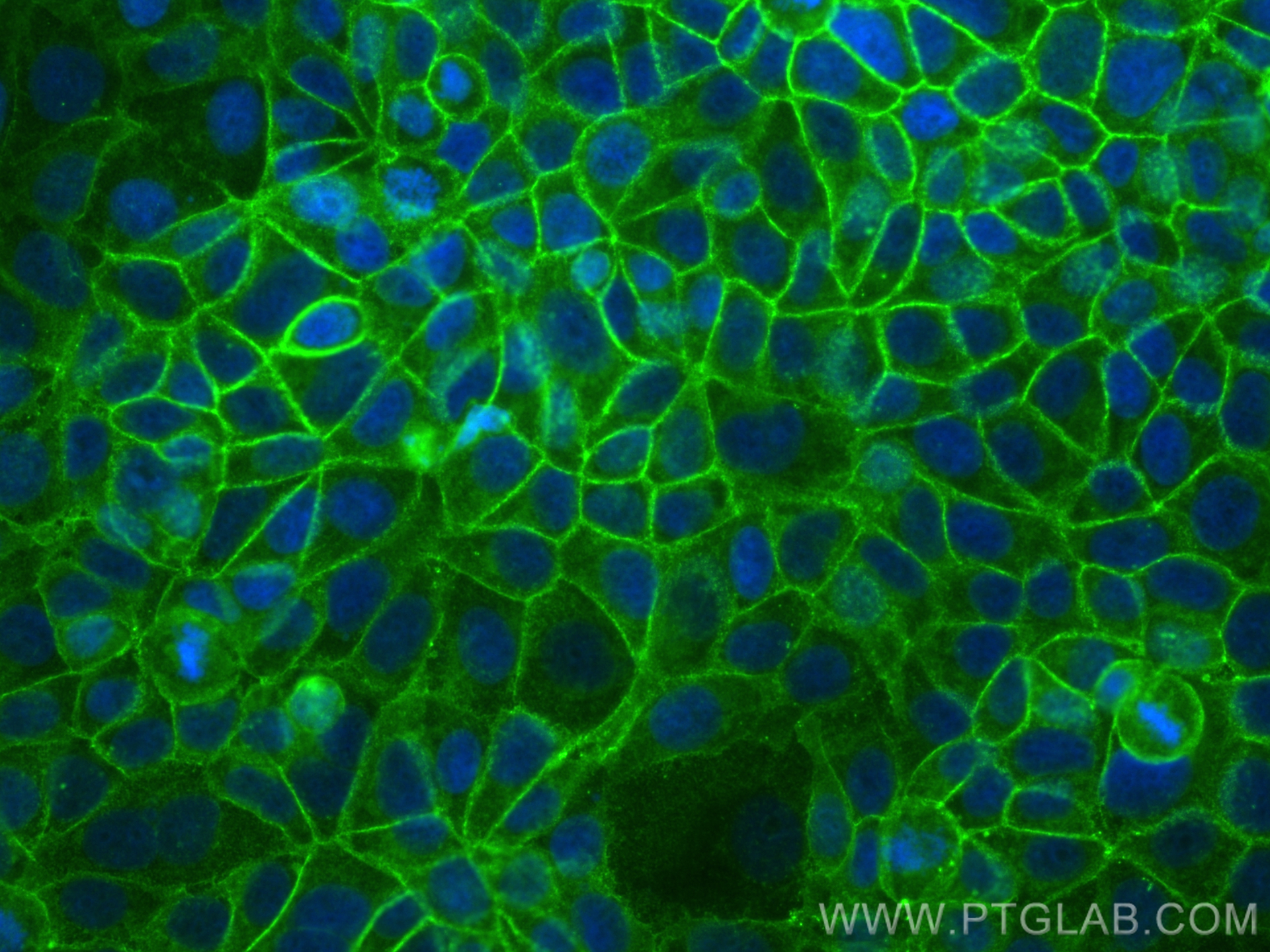 IF Staining of MCF-7 using 84142-2-RR