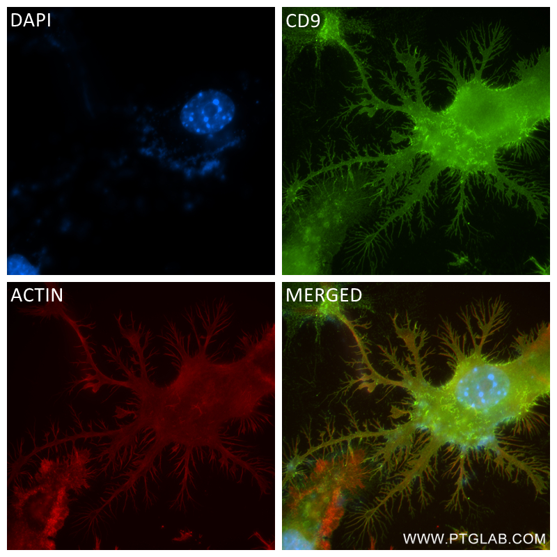 IF Staining of RAW 264.7 using 84801-4-RR (same clone as 84801-4-PBS)