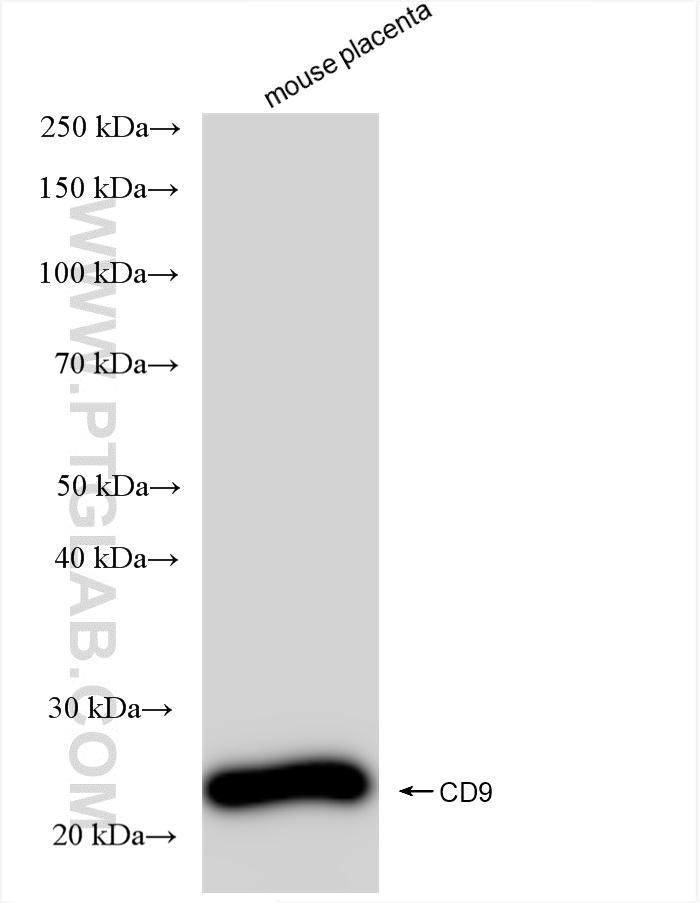 WB analysis of mouse placenta using 84801-5-RR