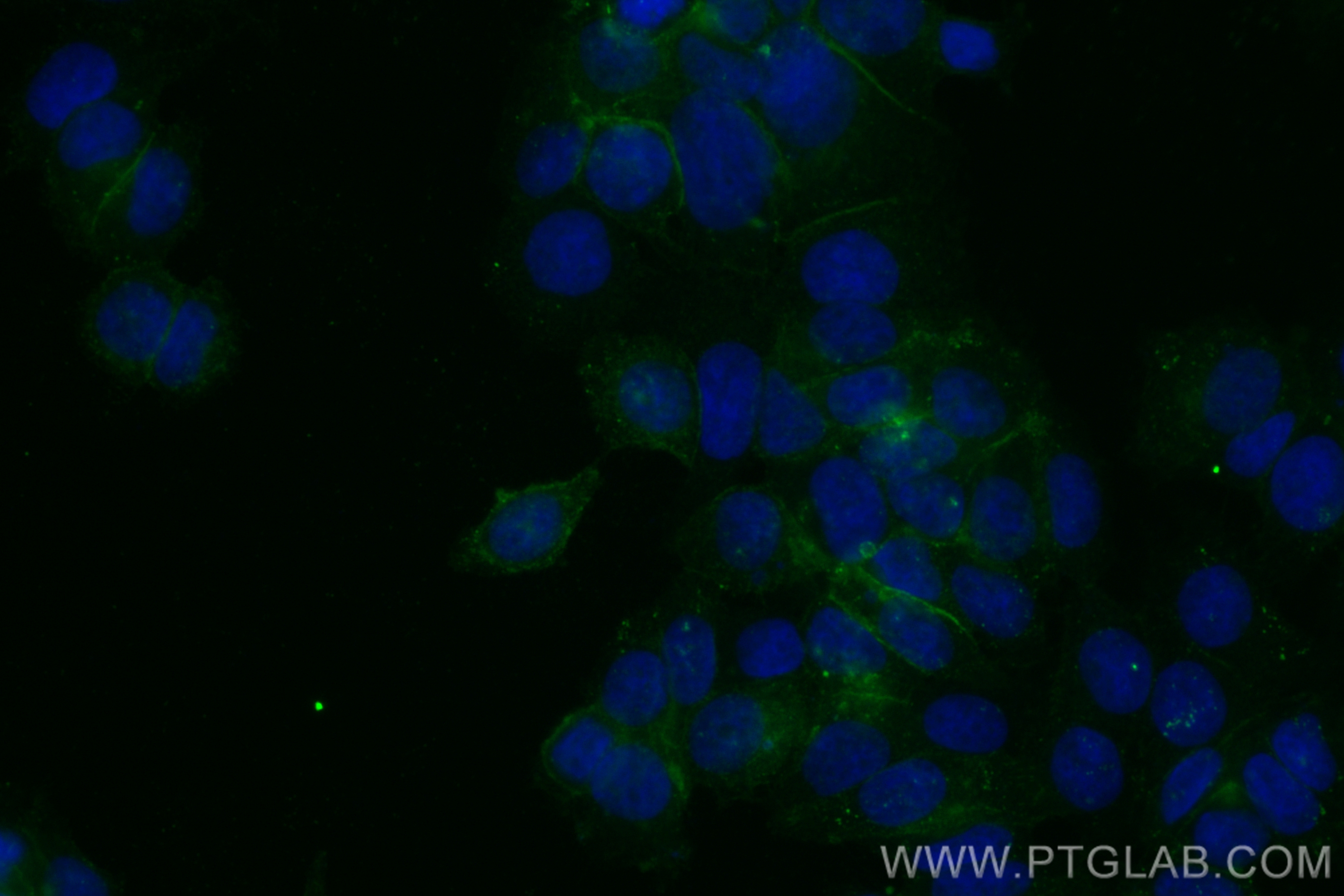 IF Staining of MCF-7 using CL488-84142-2