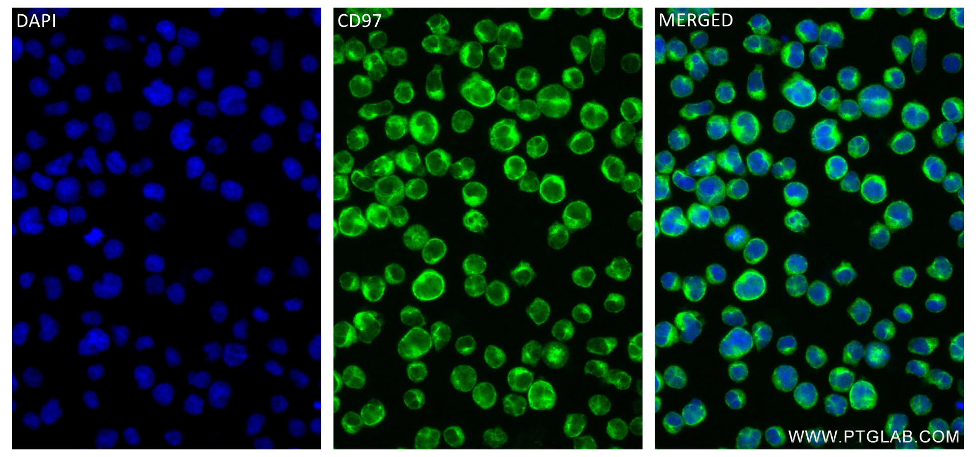 IF Staining of Jurkat using 84255-6-RR (same clone as 84255-6-PBS)